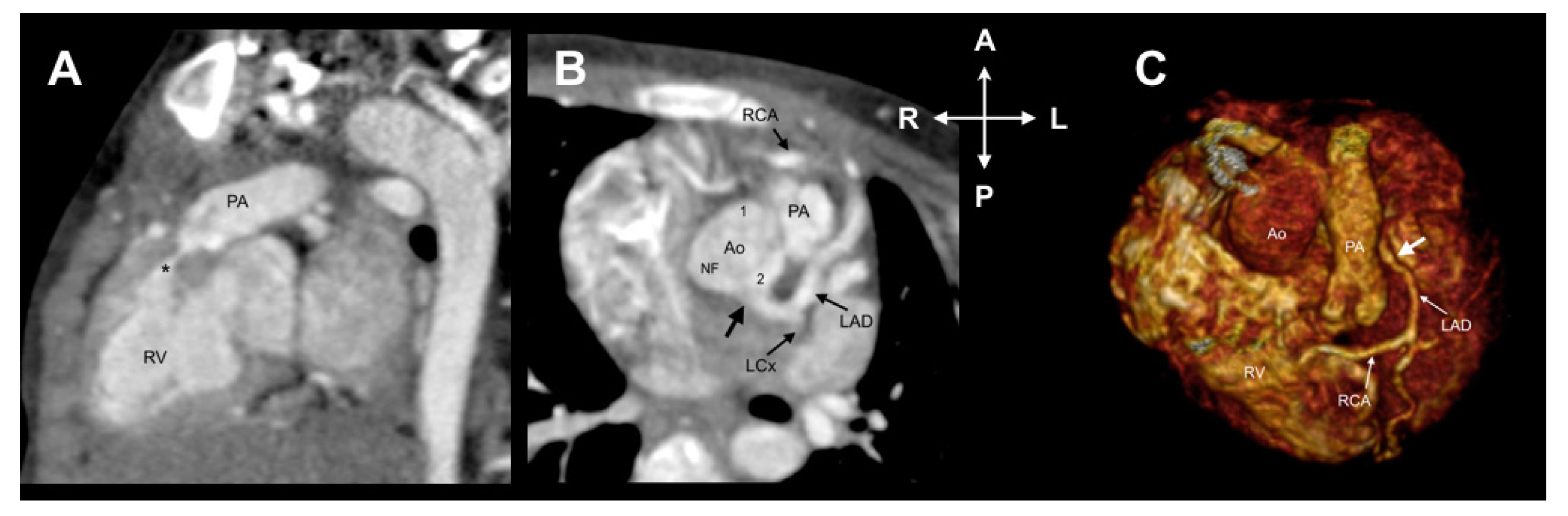 Jcdd 08 00093 g004 550