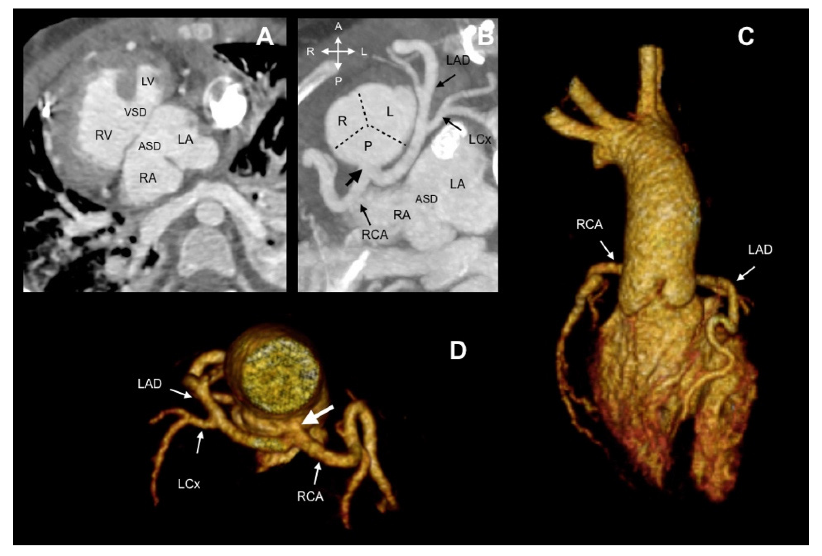 Jcdd 08 00093 g006 550