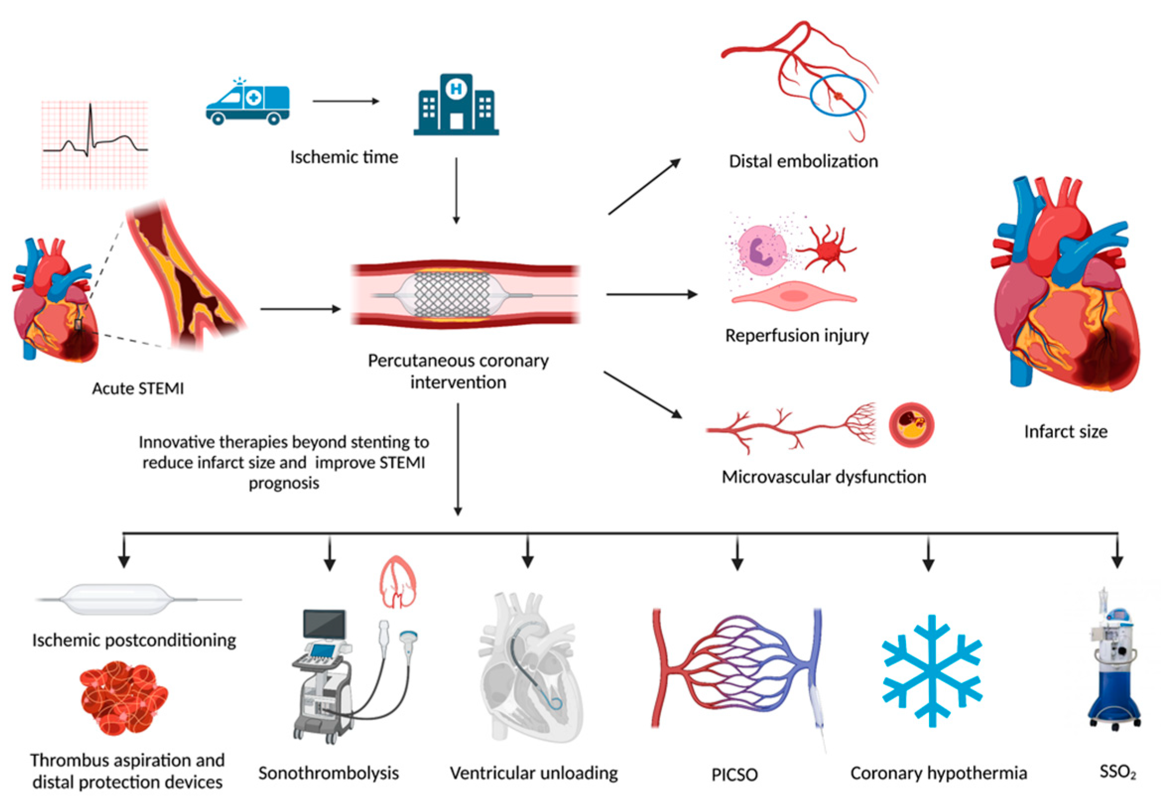 JCDD Free FullText New Interventional Therapies beyond Stenting to