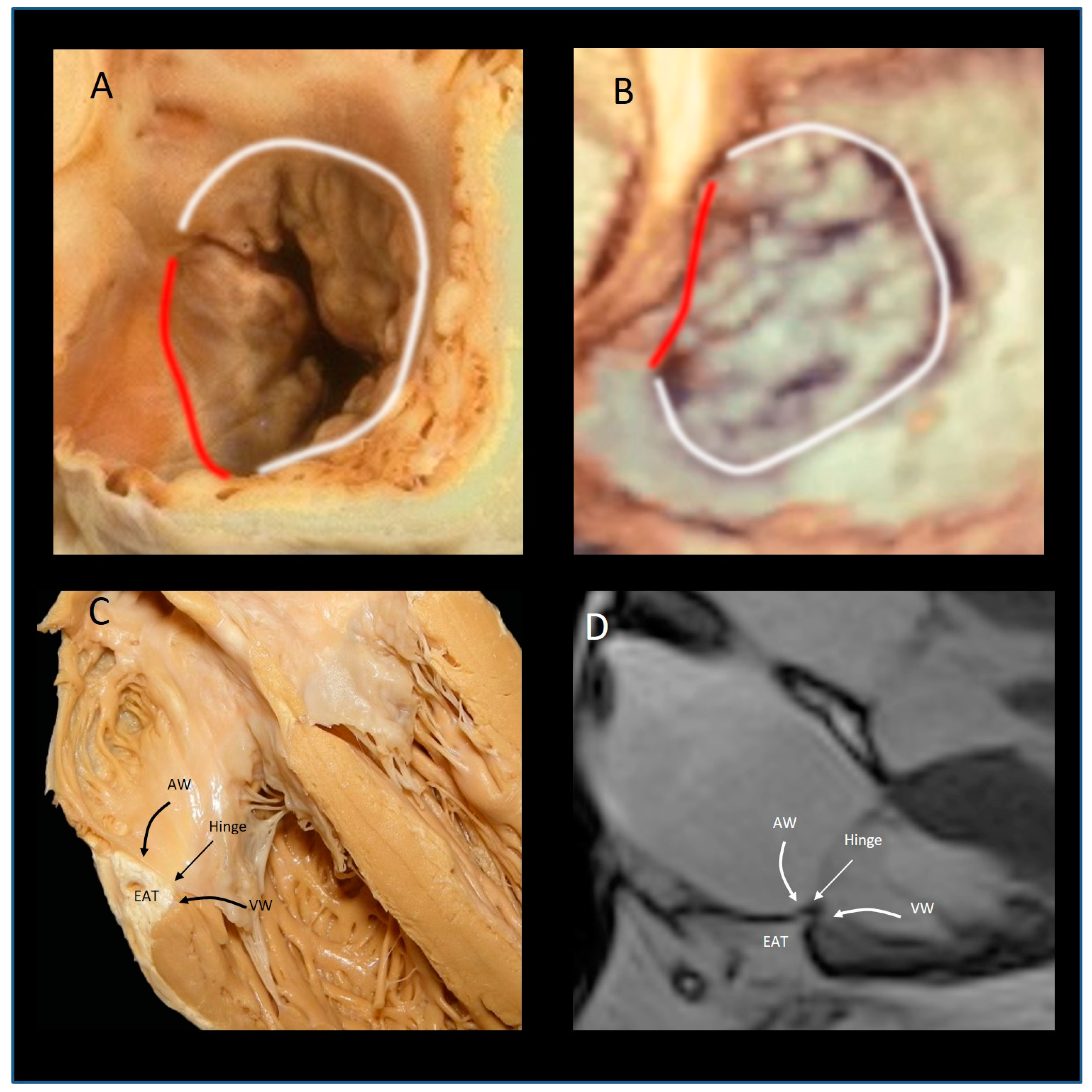 Jcdd 08 00107 g002 550