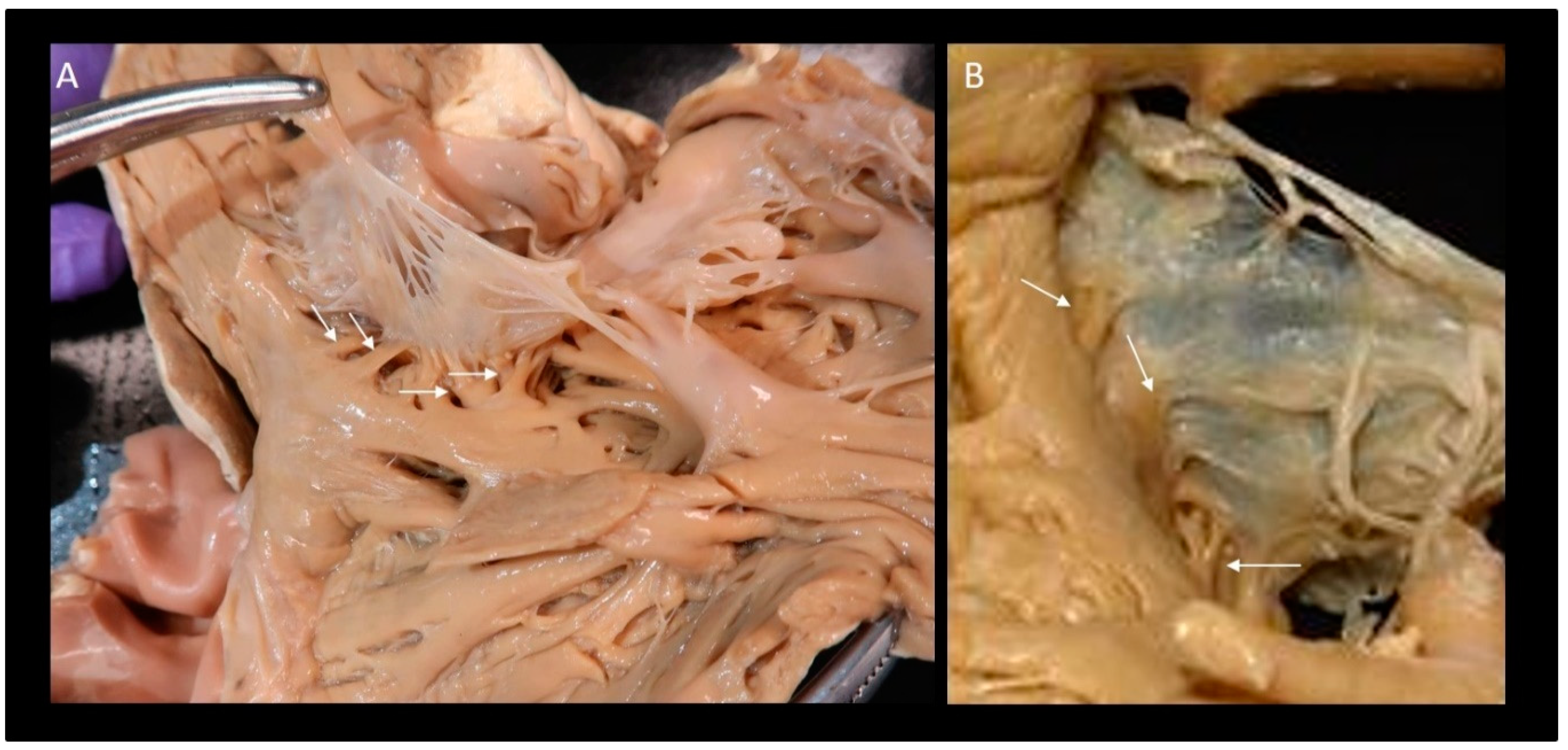 Jcdd 08 00107 g003 550