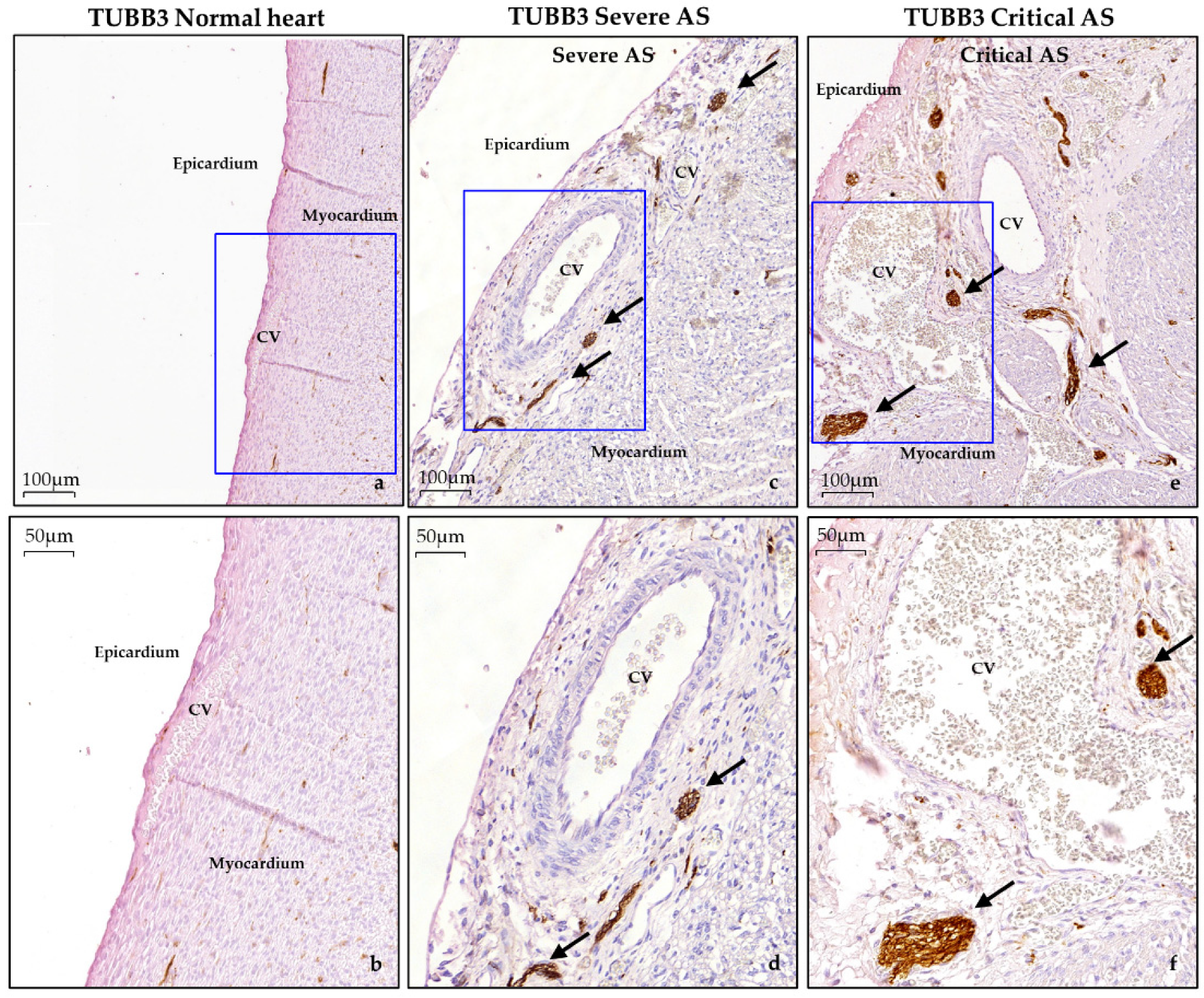 Jcdd 08 00121 g006 Jcdd 08 00121 g006