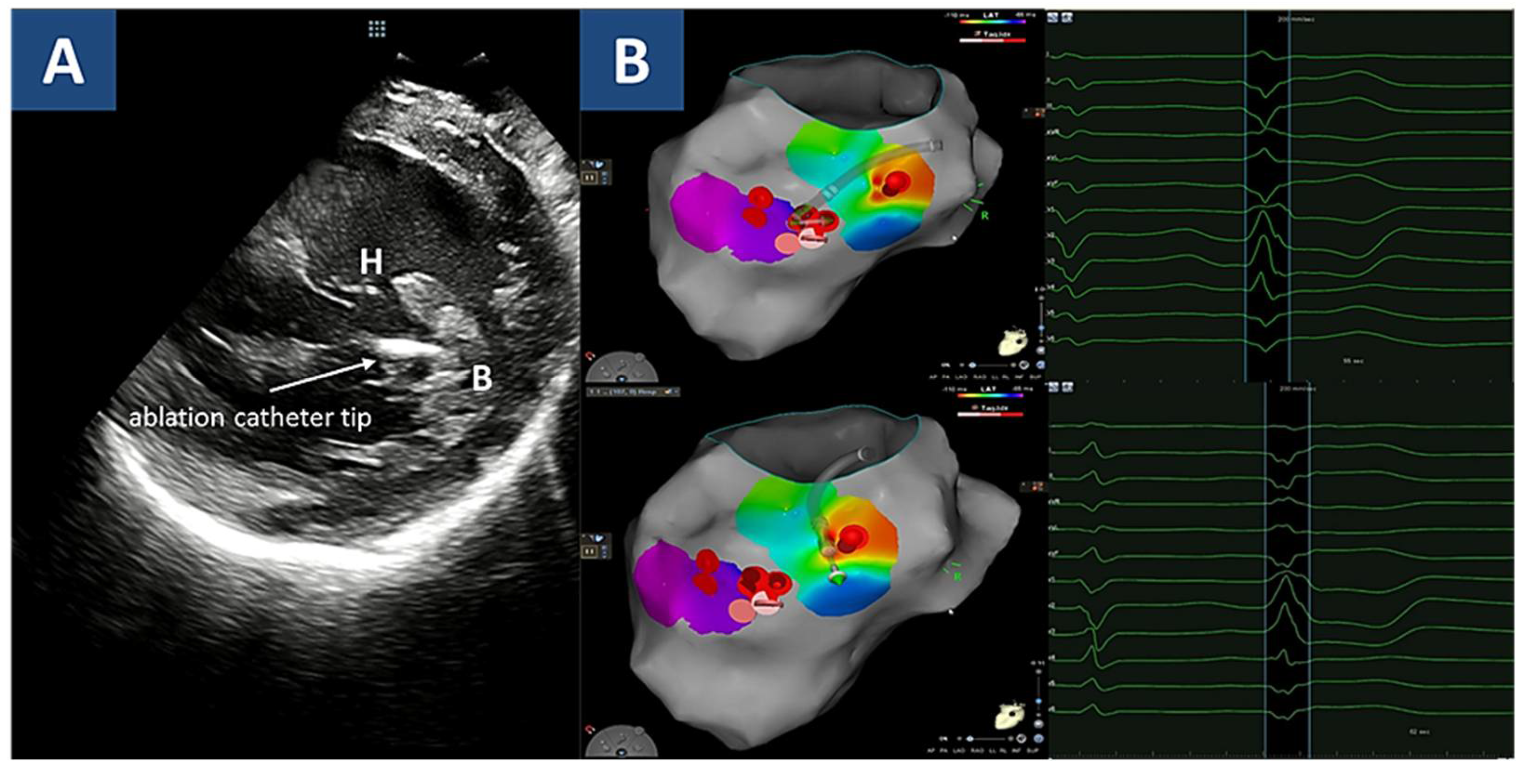 Jcdd 08 00151 g005 Jcdd 08 00151 g005