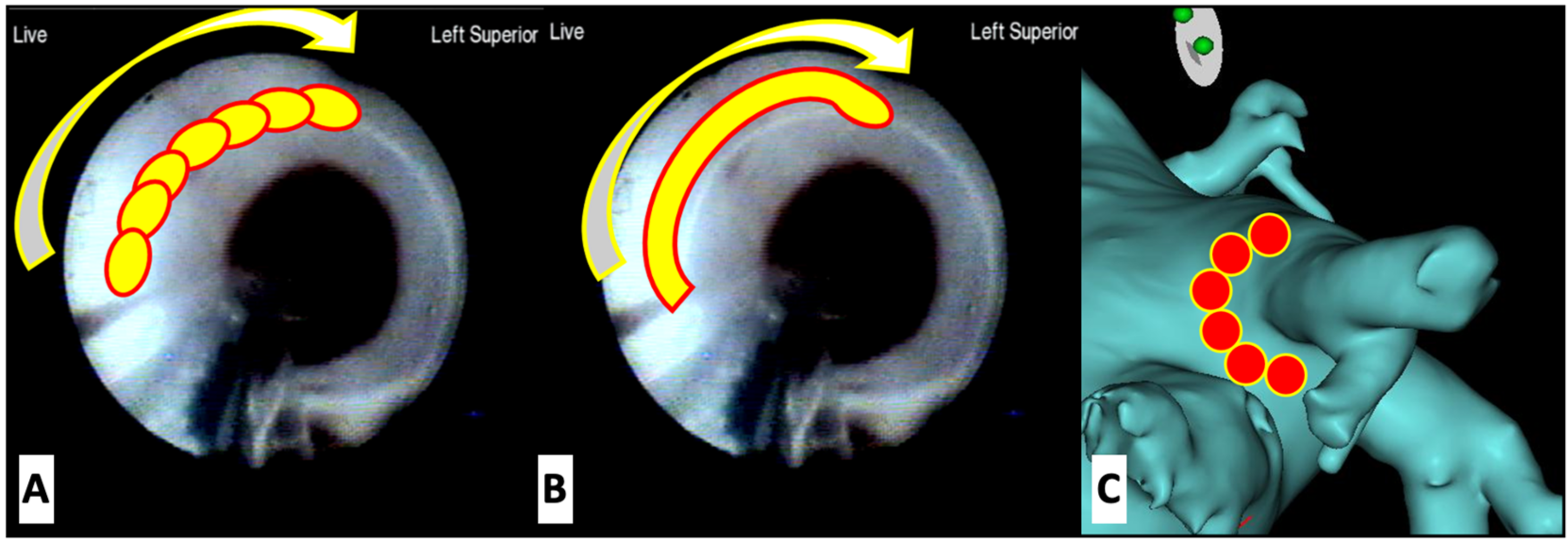 JCDD Free FullText Efficacy and Safety of Second and Third