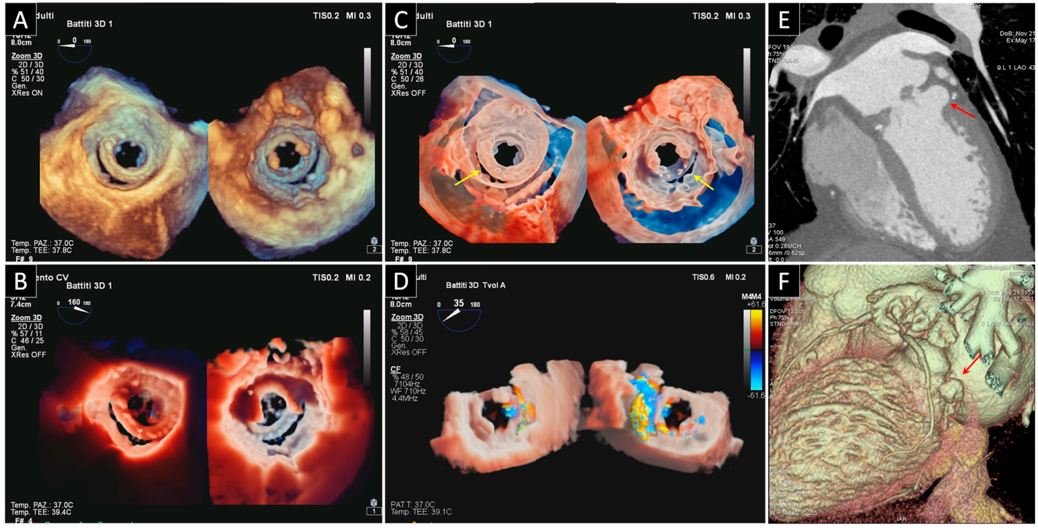 Jcdd 09 00012 g003 550