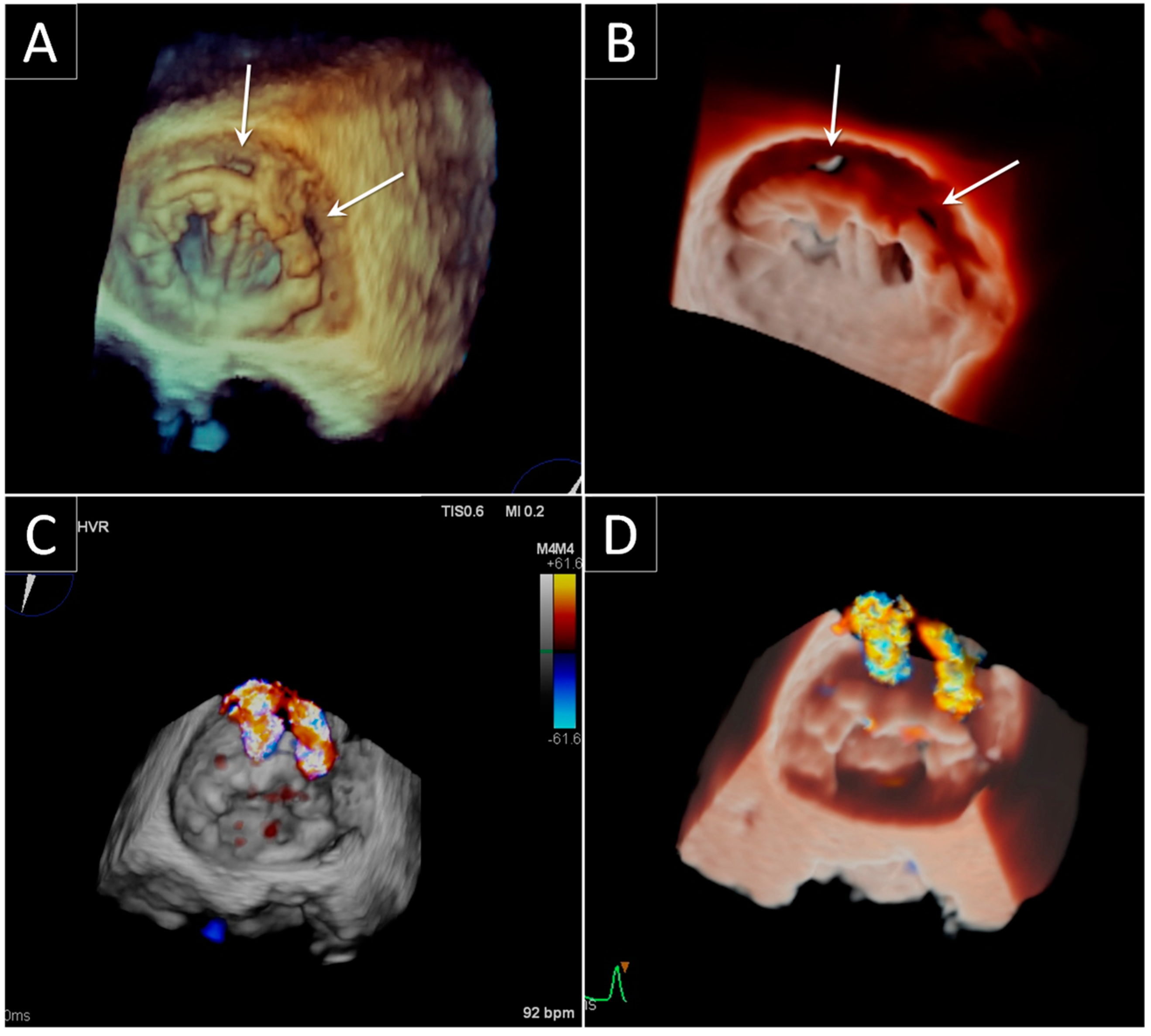 Jcdd 09 00012 g004 550