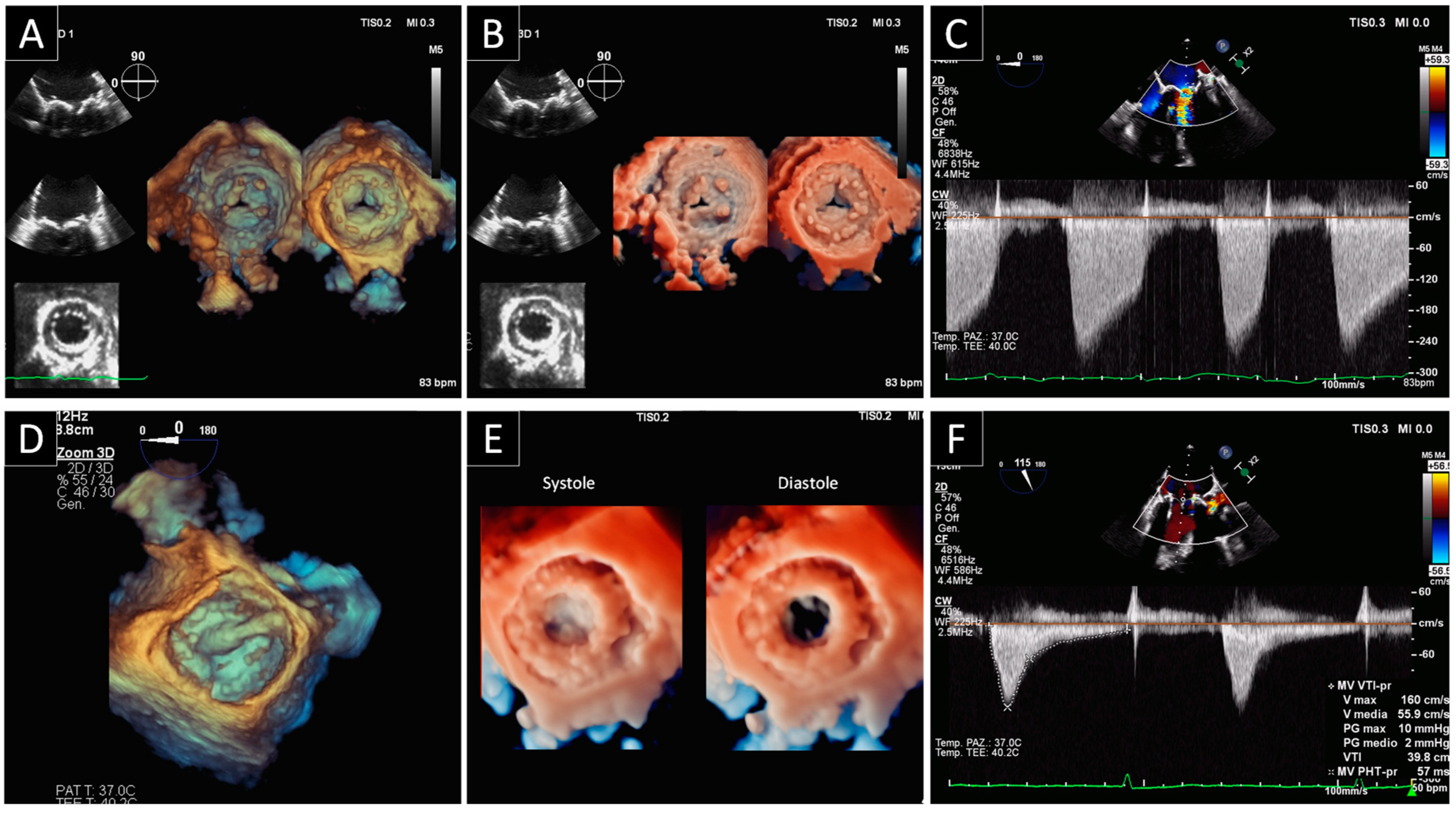 Jcdd 09 00012 g005 550