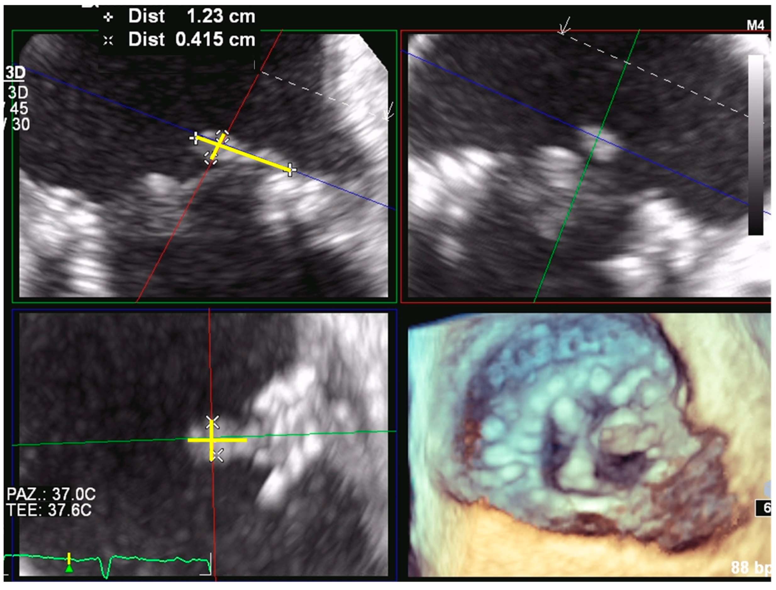 Jcdd 09 00012 g007 550