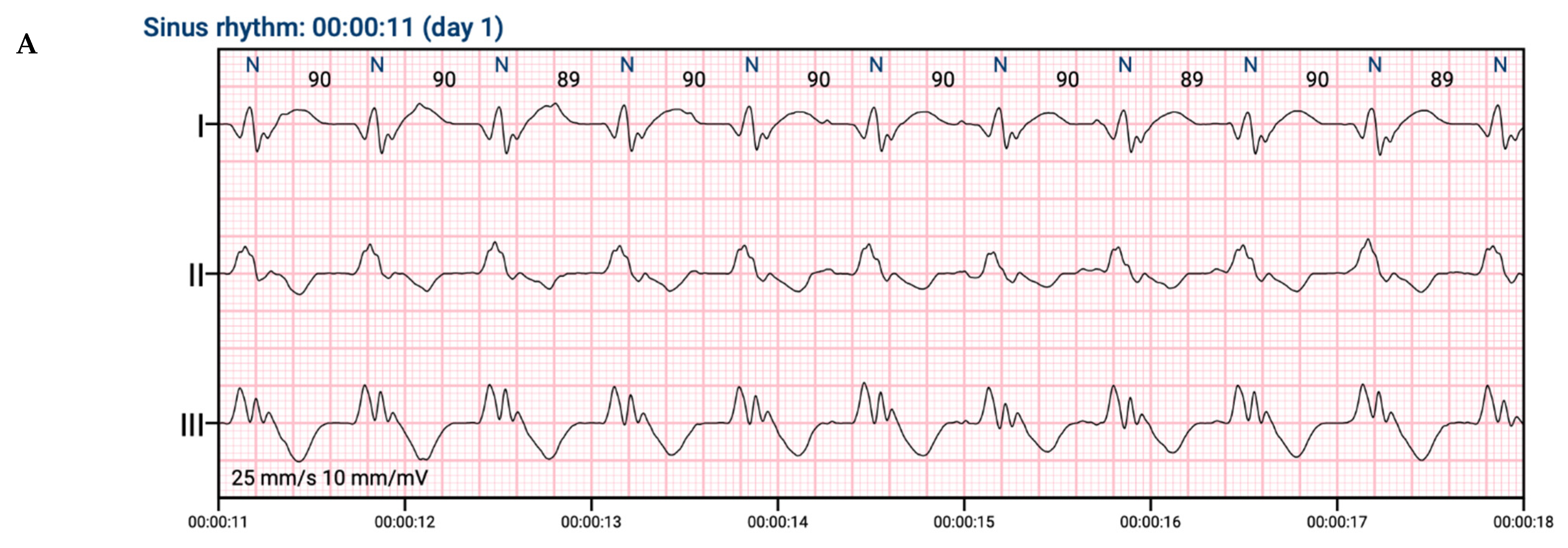 Jcdd 09 00017 g002a 550