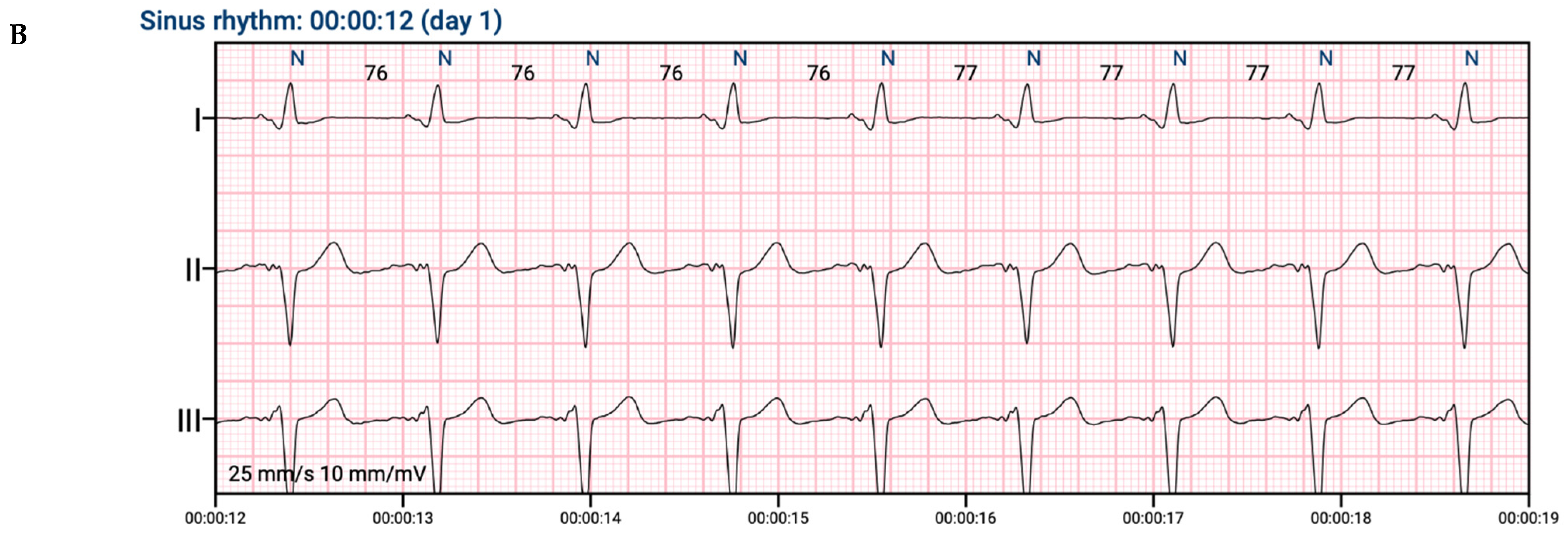 Jcdd 09 00017 g002b 550