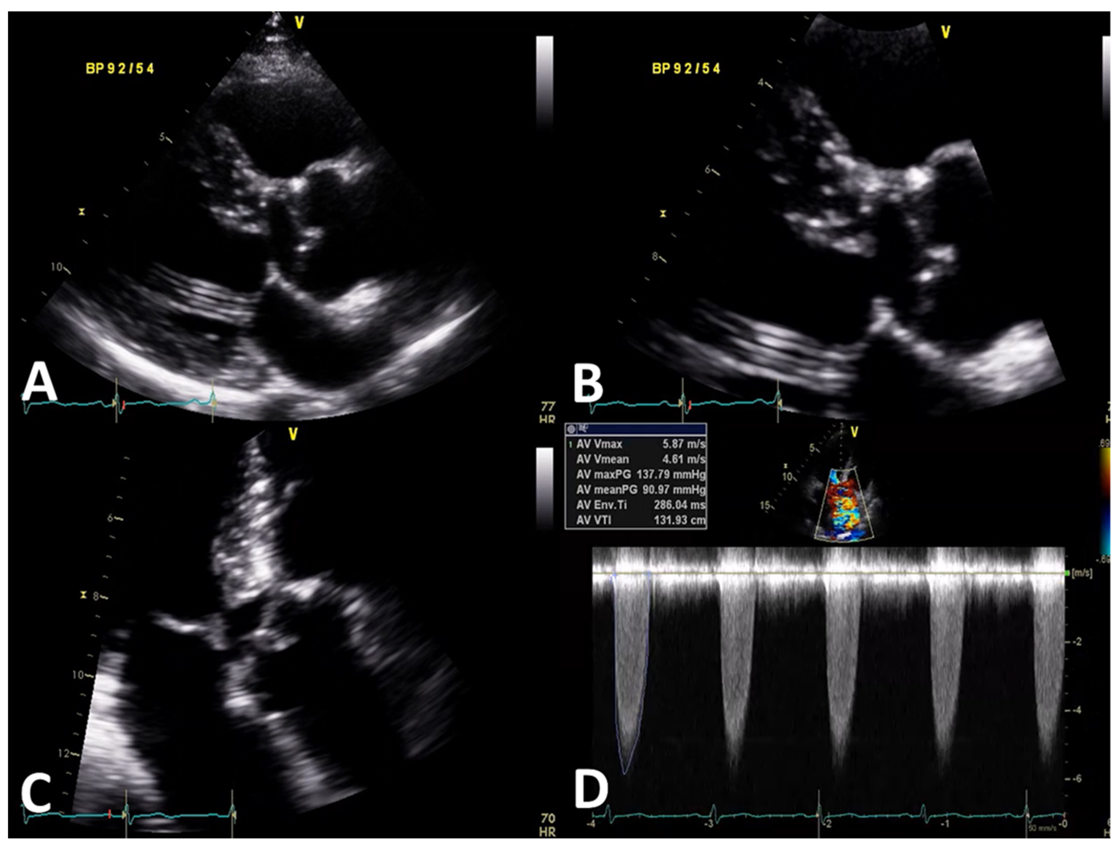 Jcdd 09 00036 g001 Jcdd 09 00036 g001