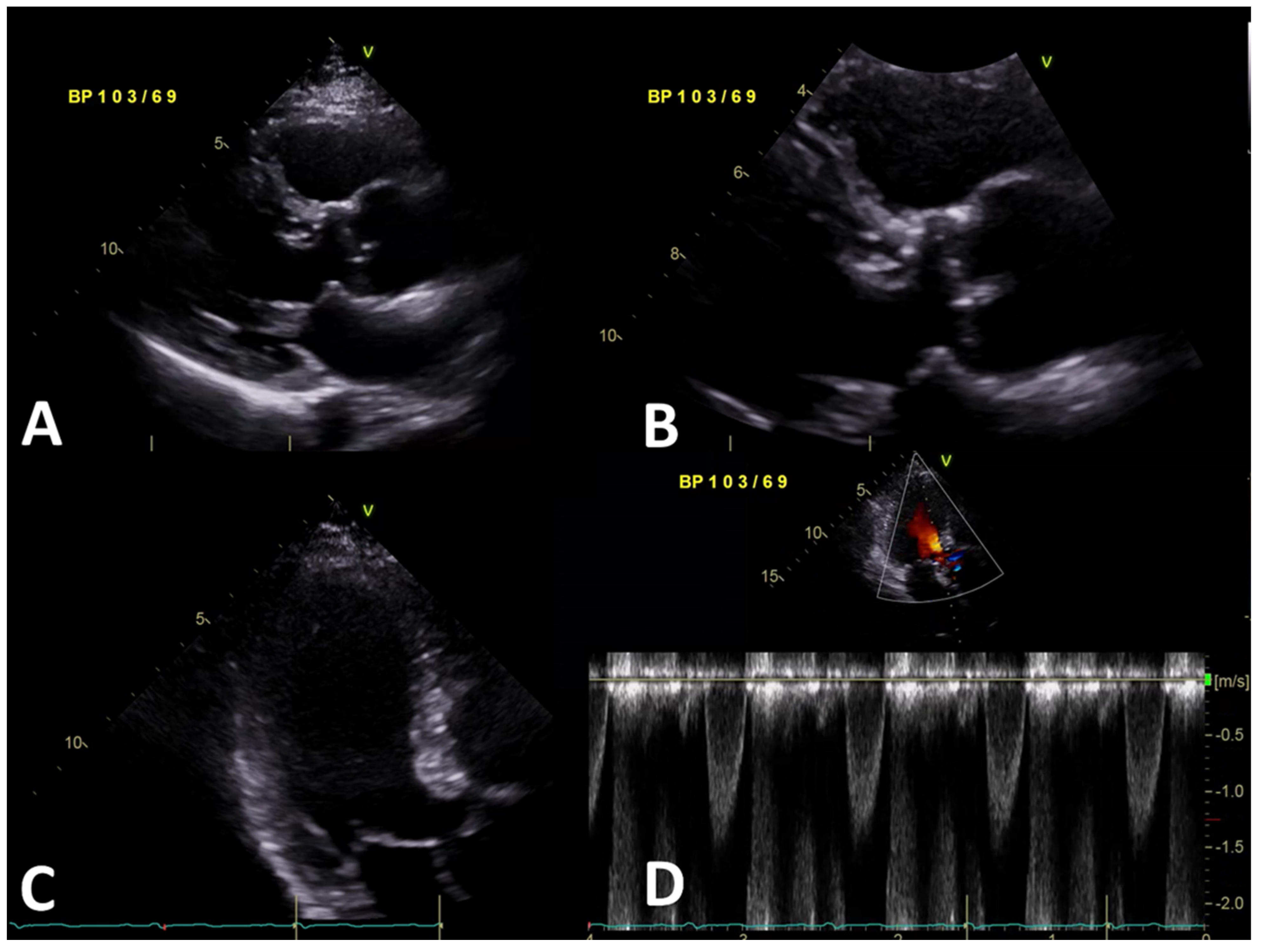 Jcdd 09 00036 g003 Jcdd 09 00036 g003