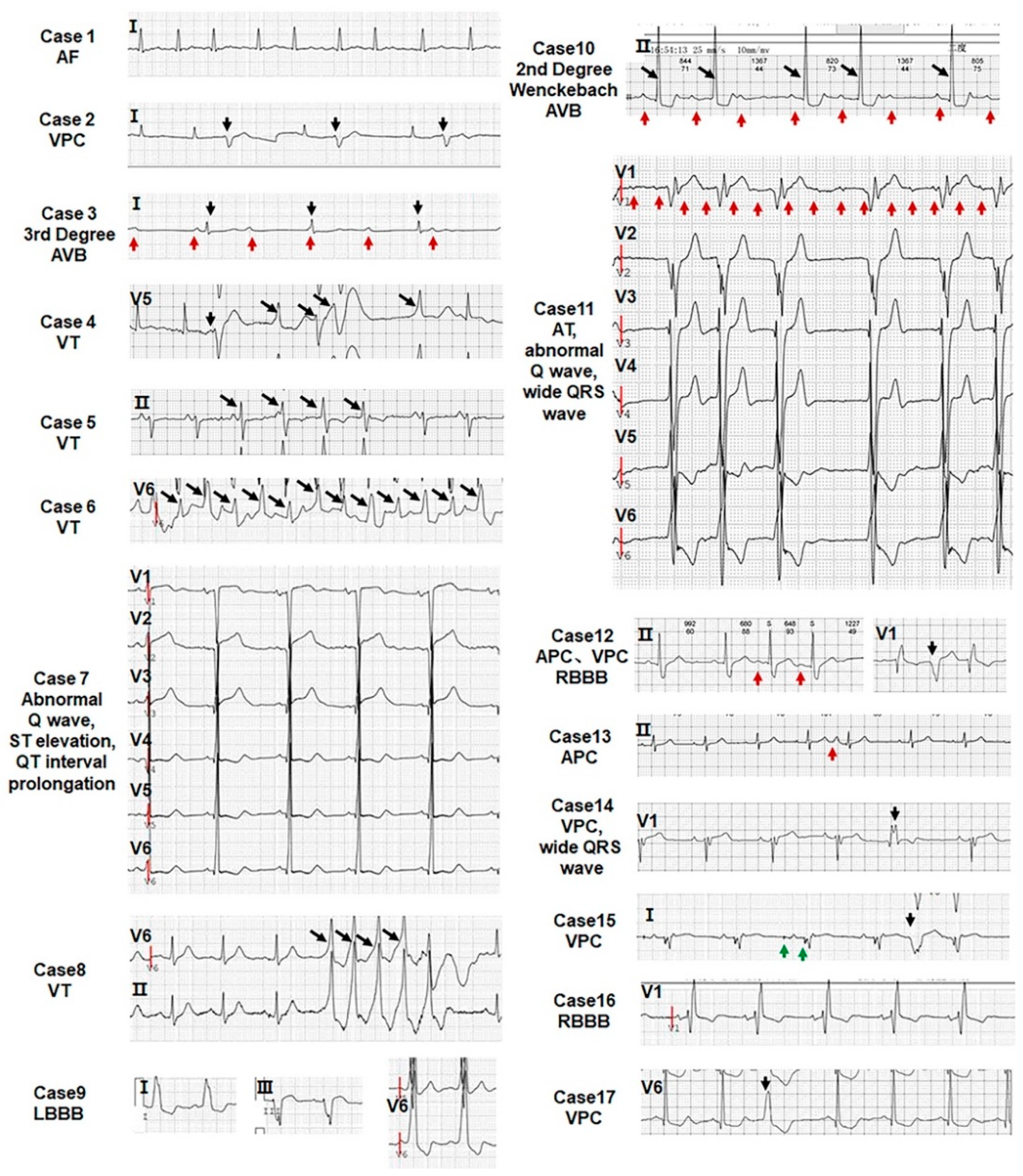Jcdd 09 00049 g004 Jcdd 09 00049 g004