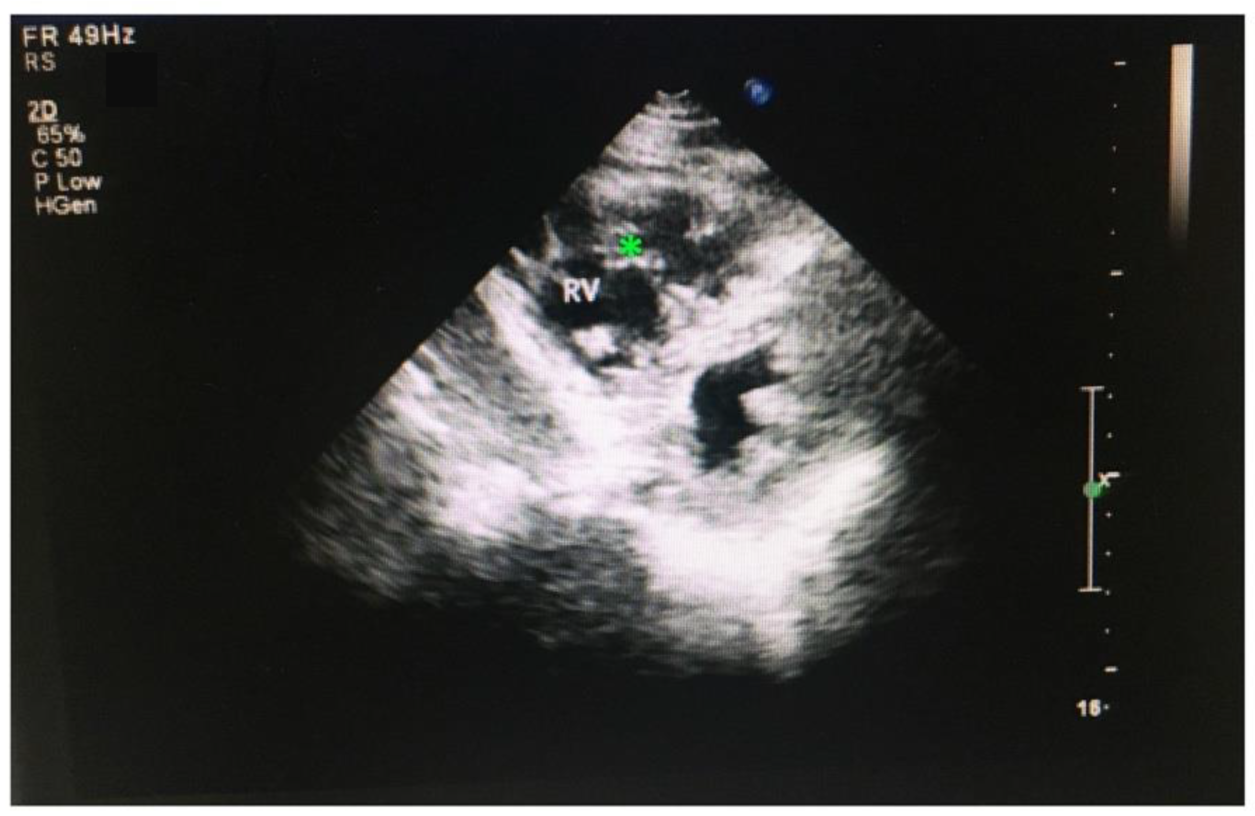 Jcdd 09 00049 g005 Jcdd 09 00049 g005