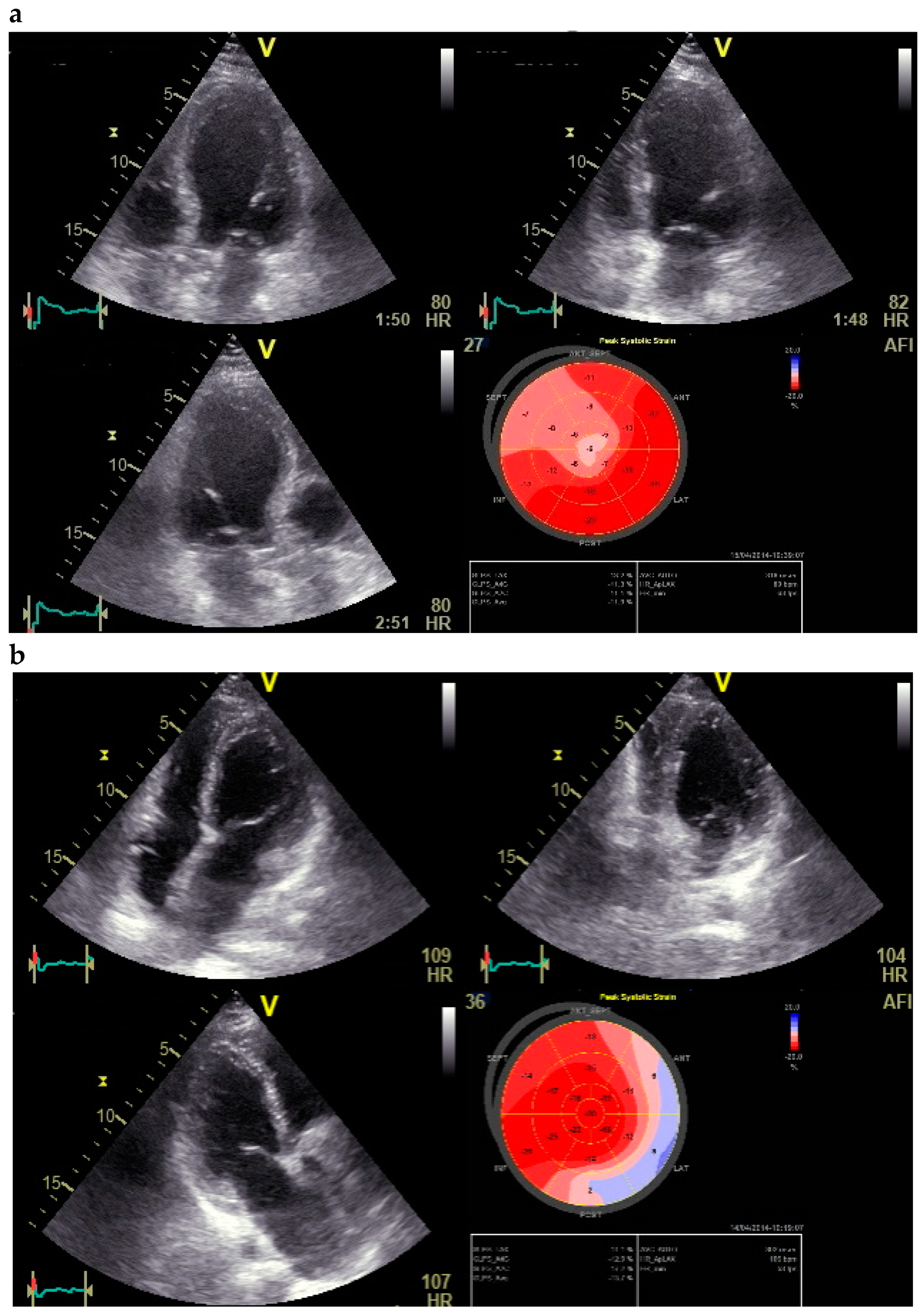 Jcdd 09 00123 g002 550