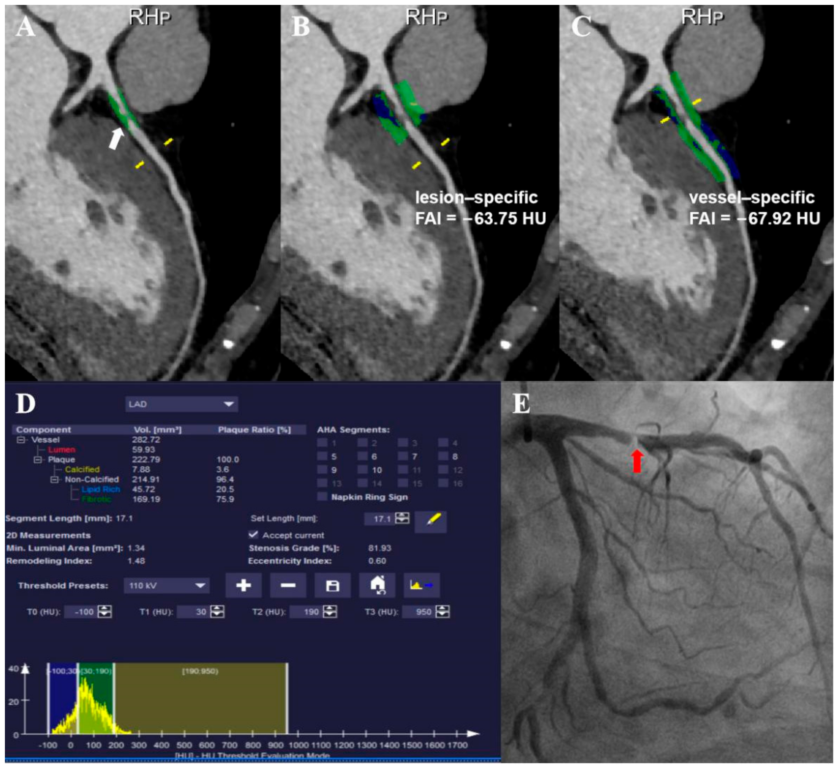 Jcdd 09 00128 g004 550