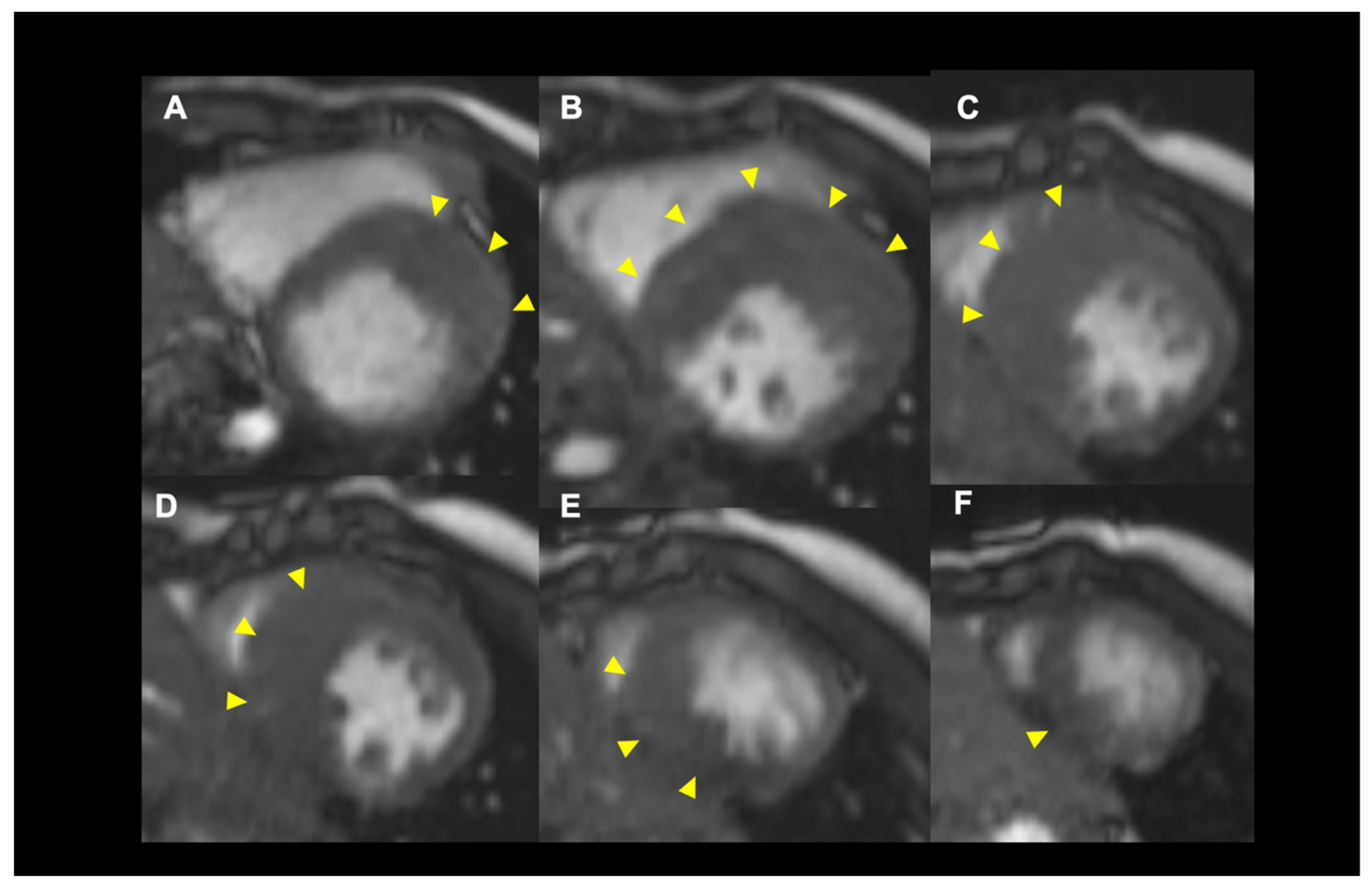 Jcdd 09 00169 g002 Jcdd 09 00169 g002