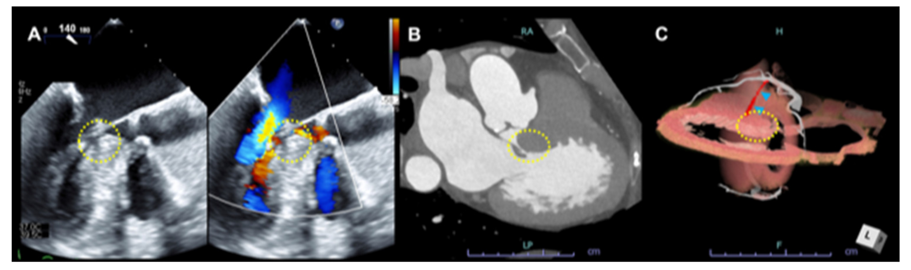 Jcdd 09 00169 g005 Jcdd 09 00169 g005
