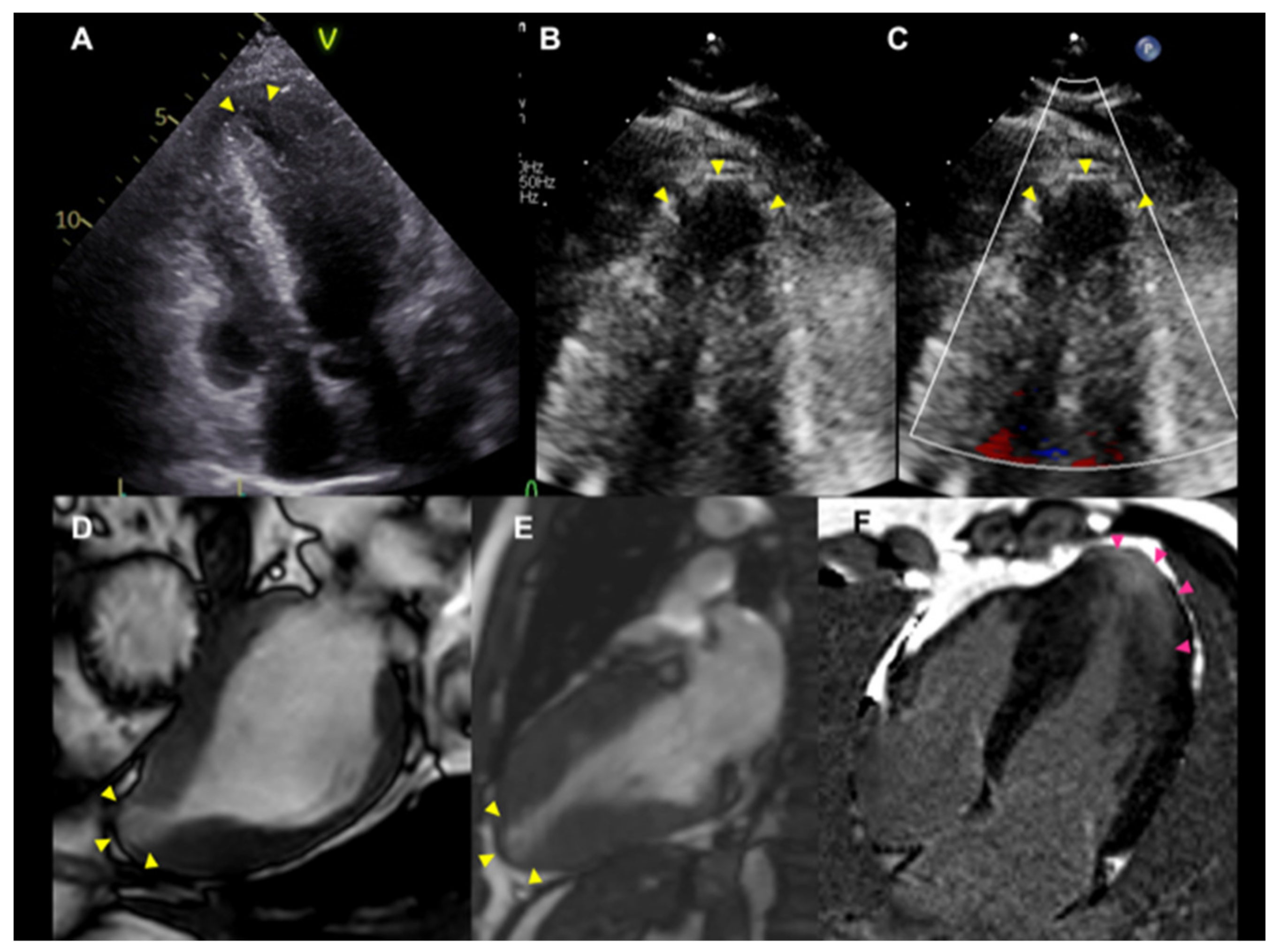 Jcdd 09 00169 g006 Jcdd 09 00169 g006