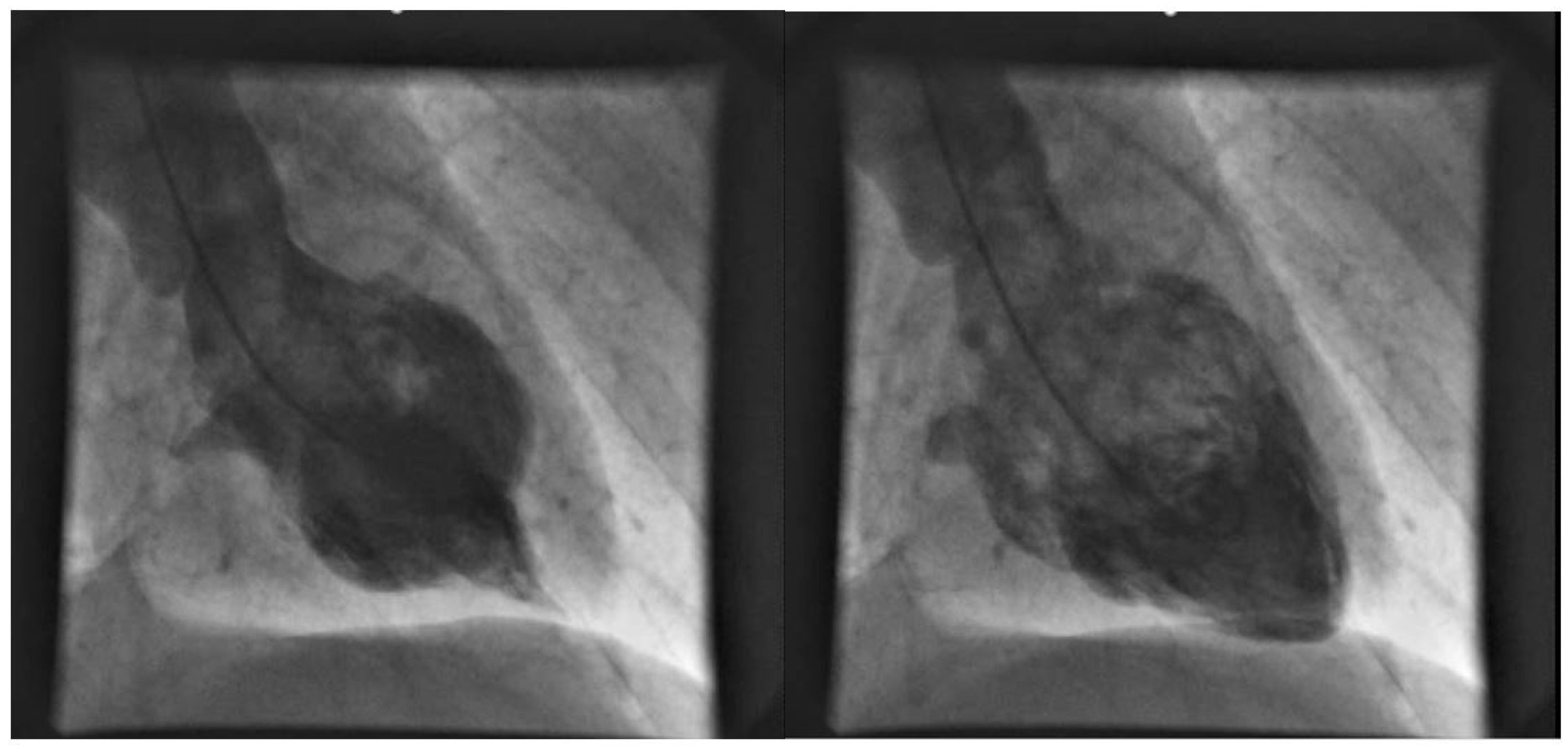 Jcdd 09 00186 g001 Jcdd 09 00186 g001