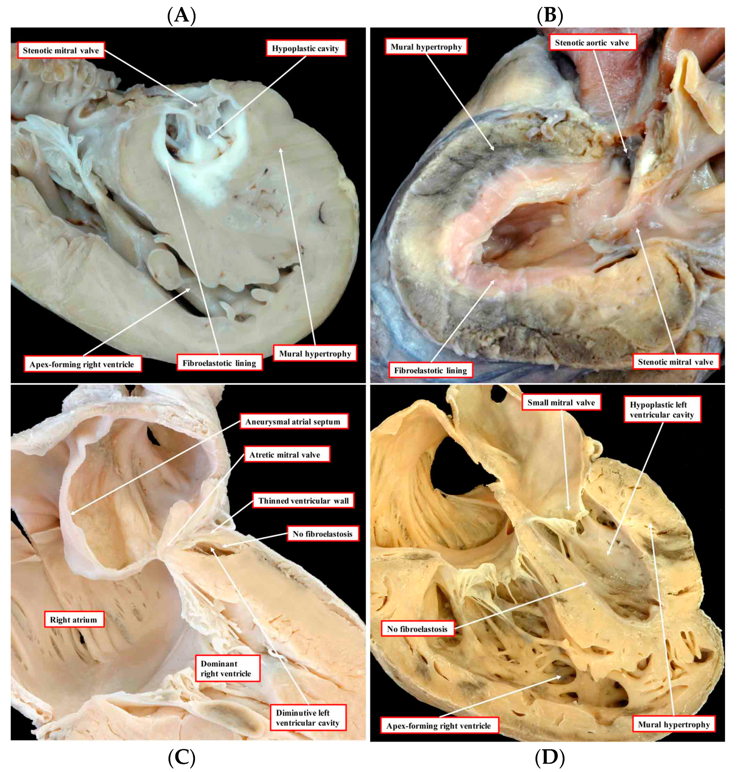 Jcdd 09 00219 g001 550