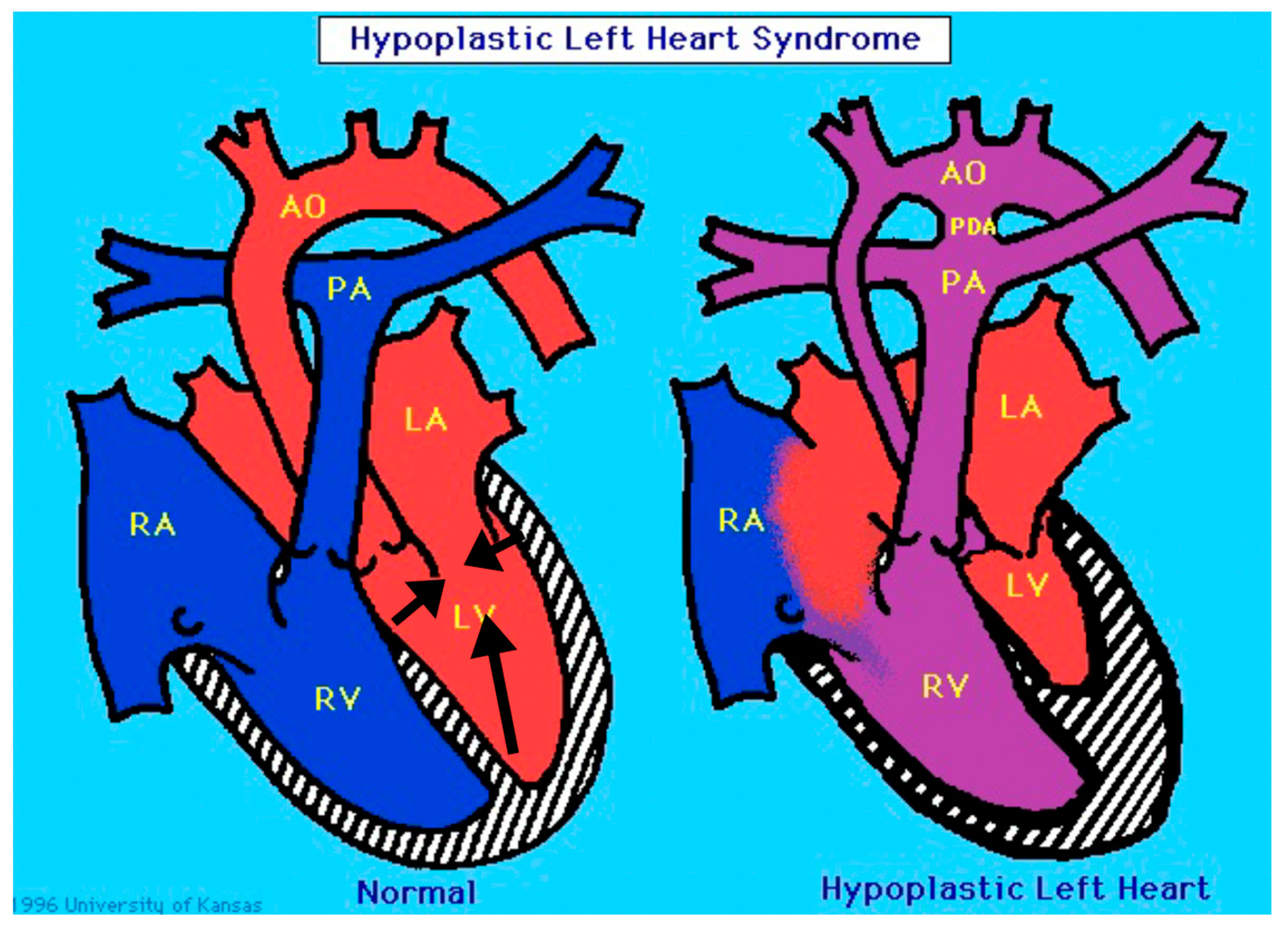 Jcdd 09 00219 g005 550