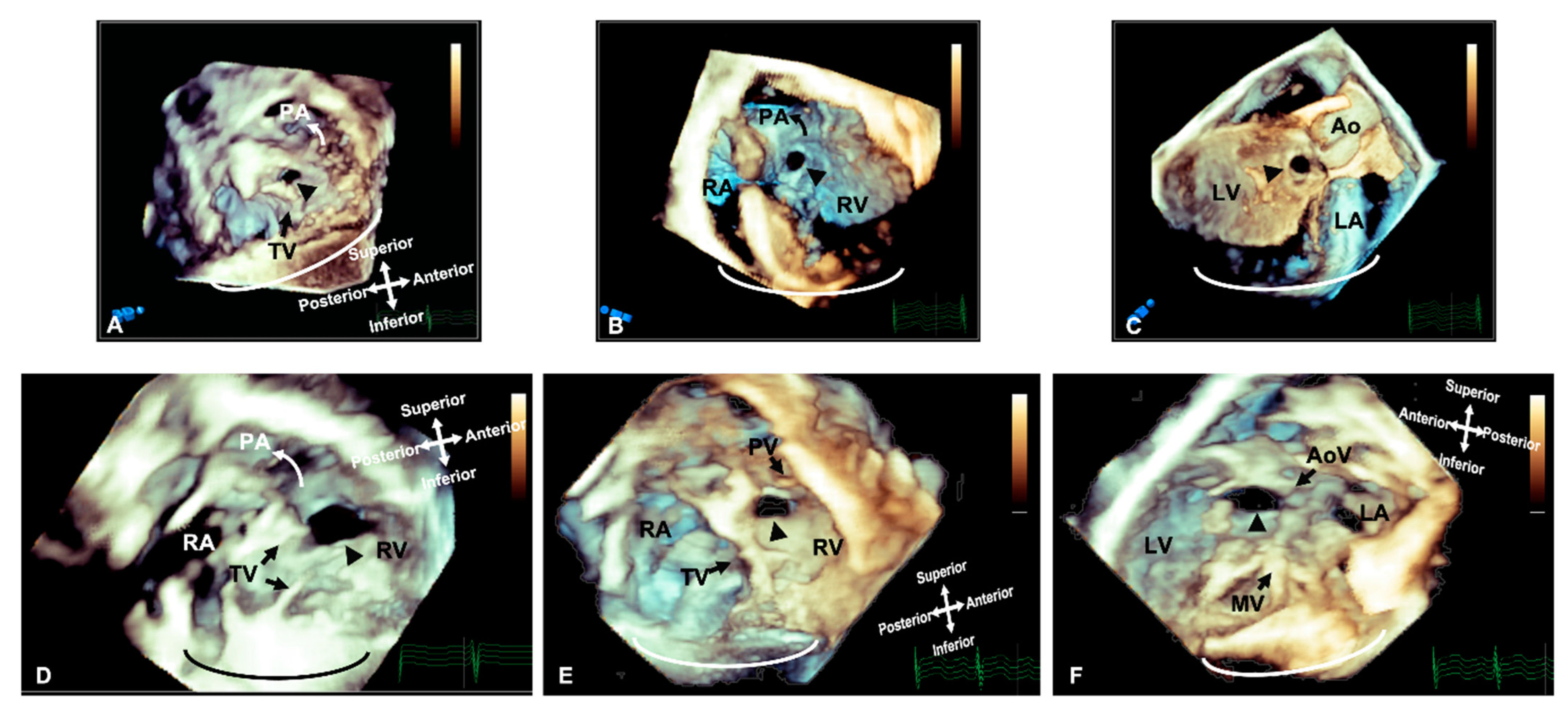 Jcdd 09 00269 g001 Jcdd 09 00269 g001