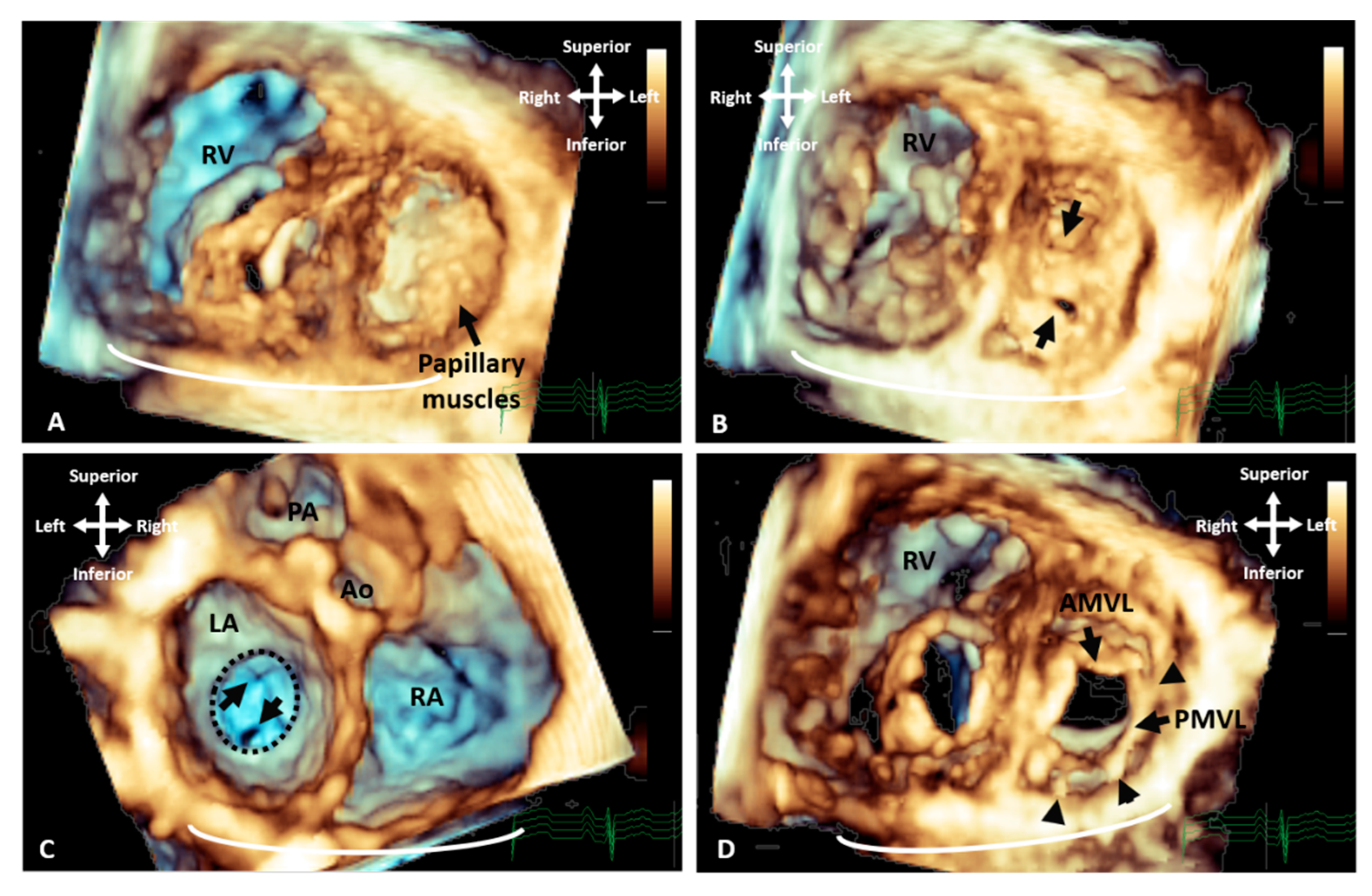 Jcdd 09 00269 g002 Jcdd 09 00269 g002