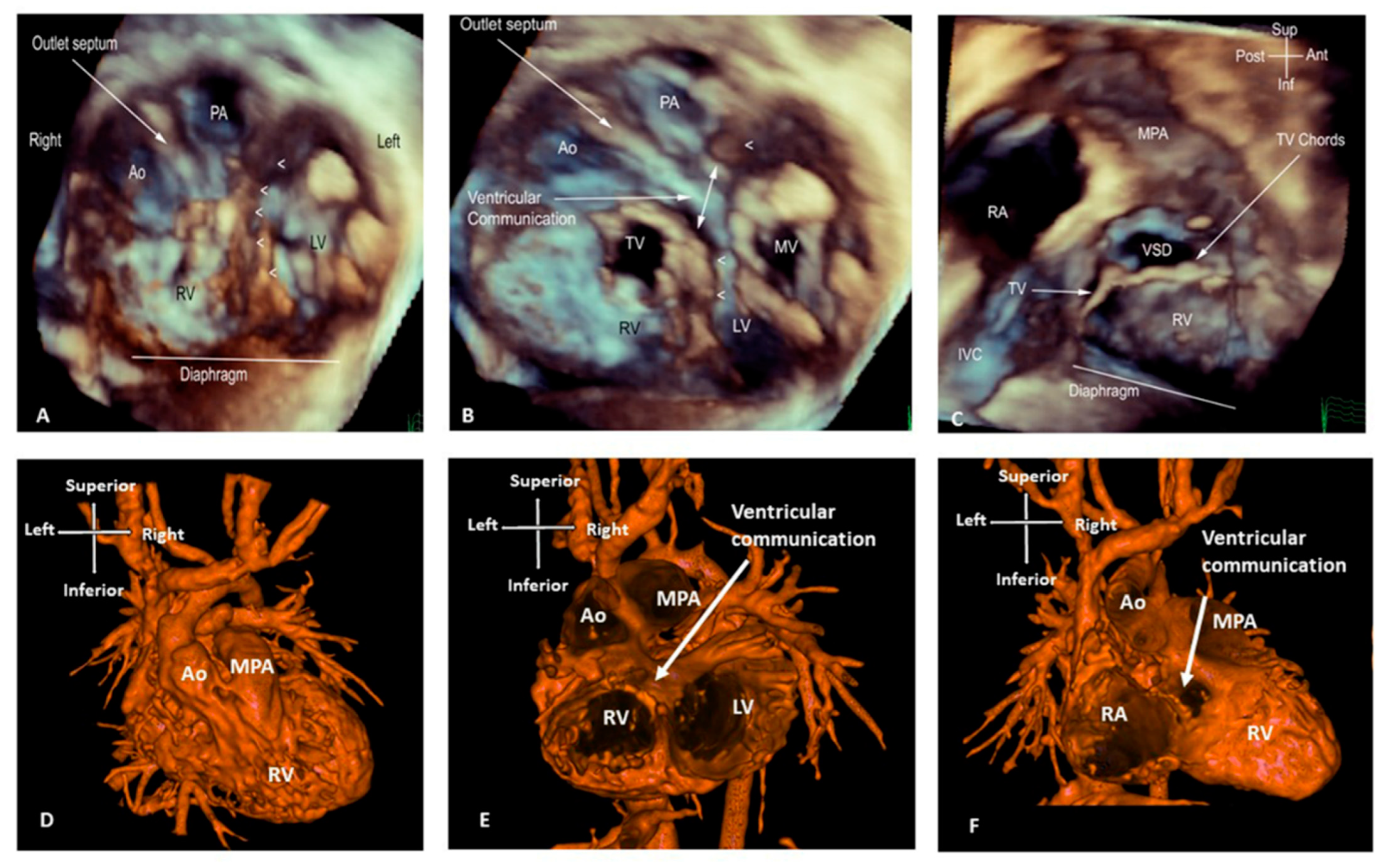 Jcdd 09 00269 g004 Jcdd 09 00269 g004