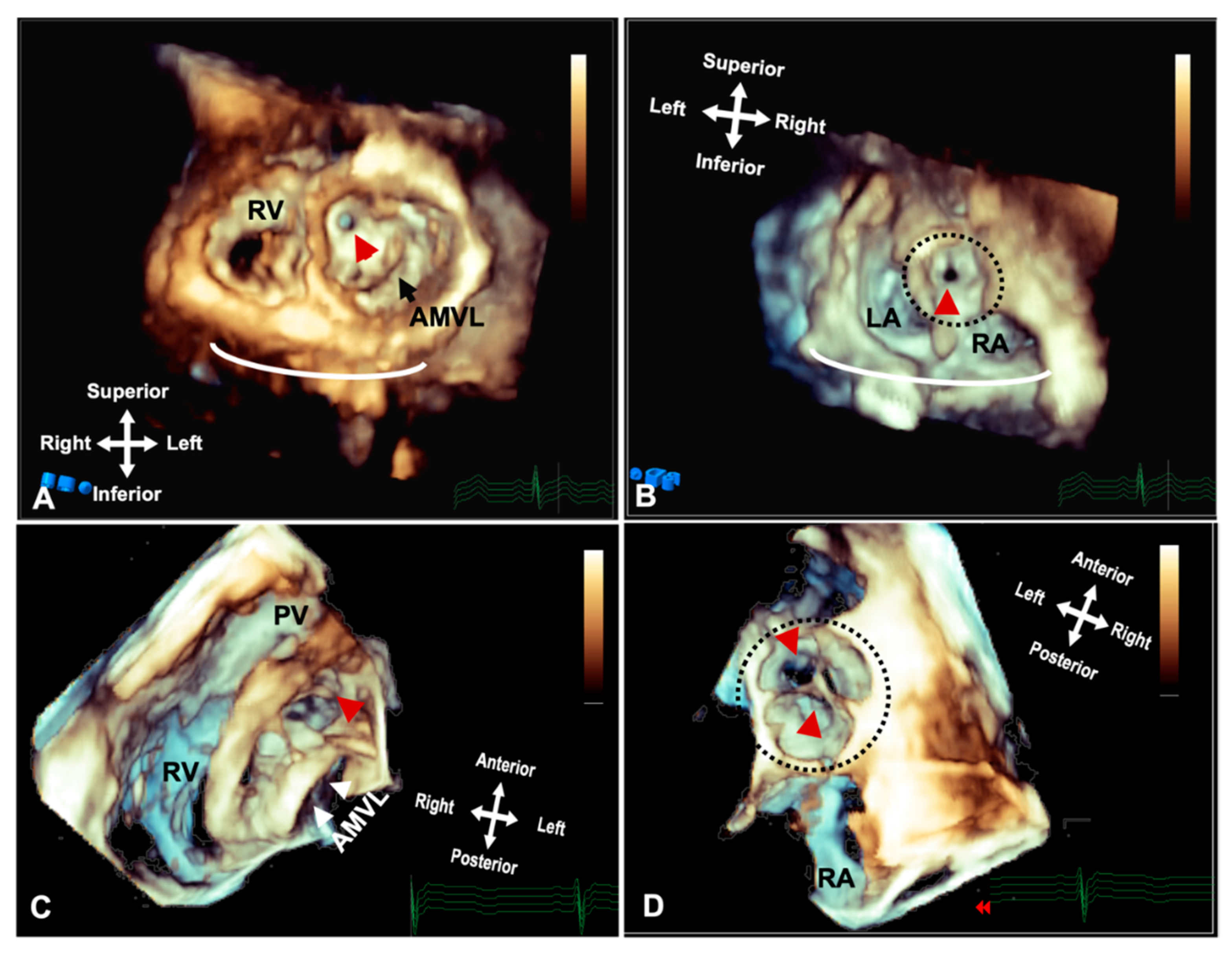 Jcdd 09 00269 g005 Jcdd 09 00269 g005