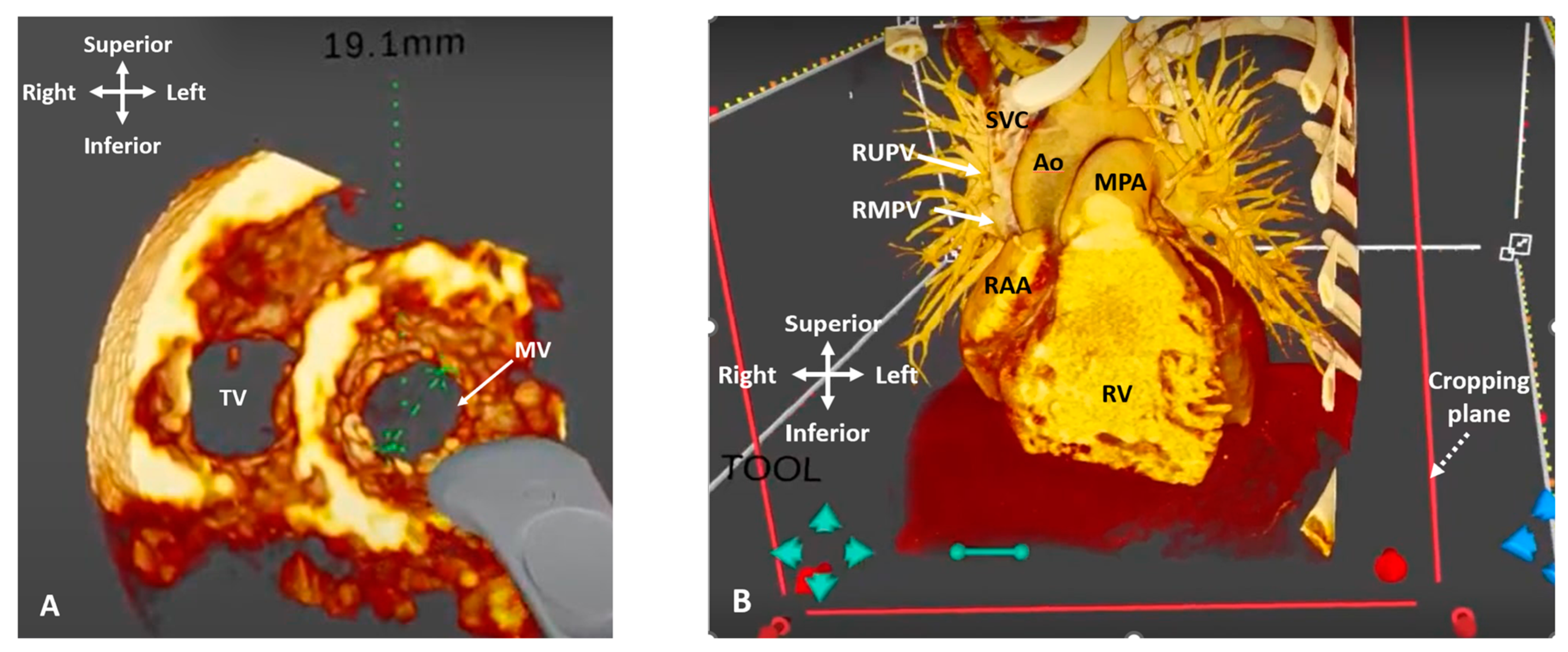 Jcdd 09 00269 g013 Jcdd 09 00269 g013