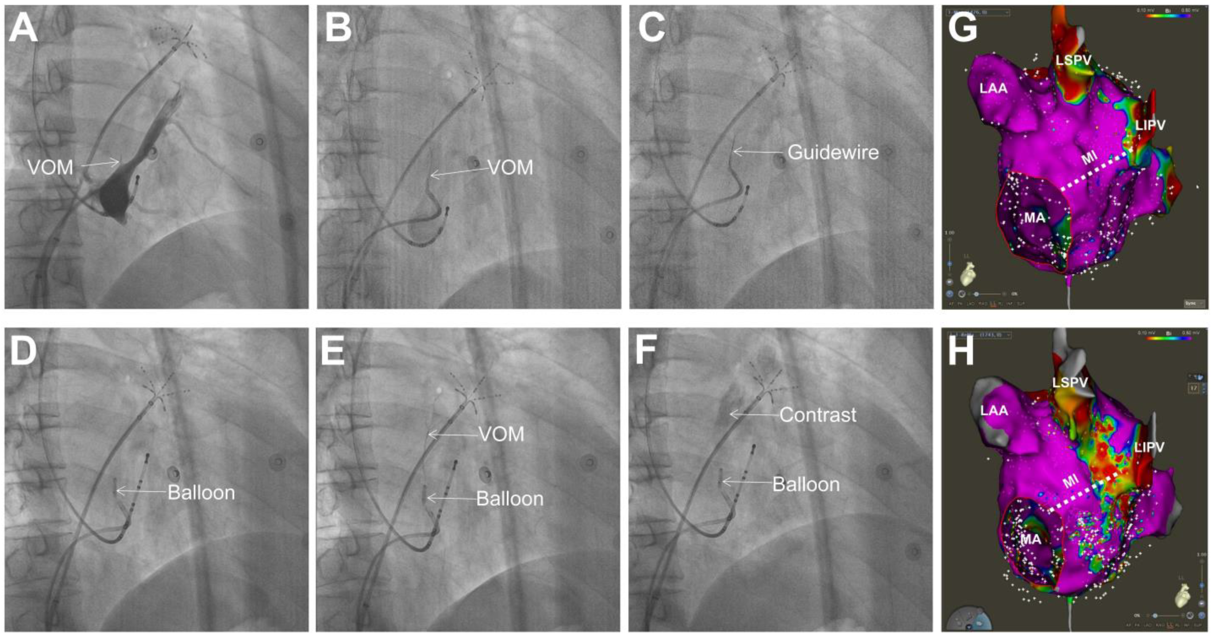 Jcdd 09 00270 g004 550
