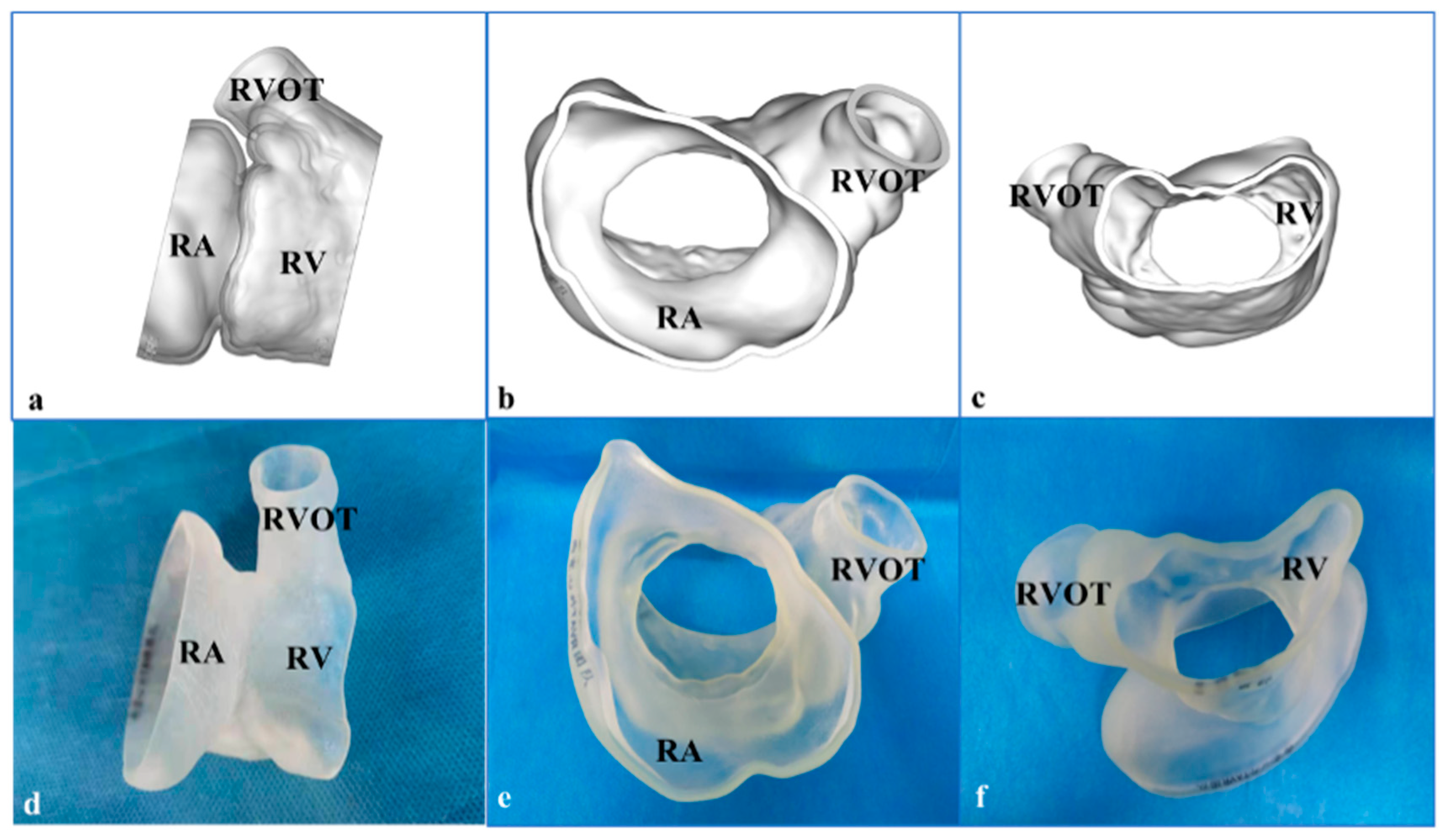 Jcdd 09 00296 g003 550