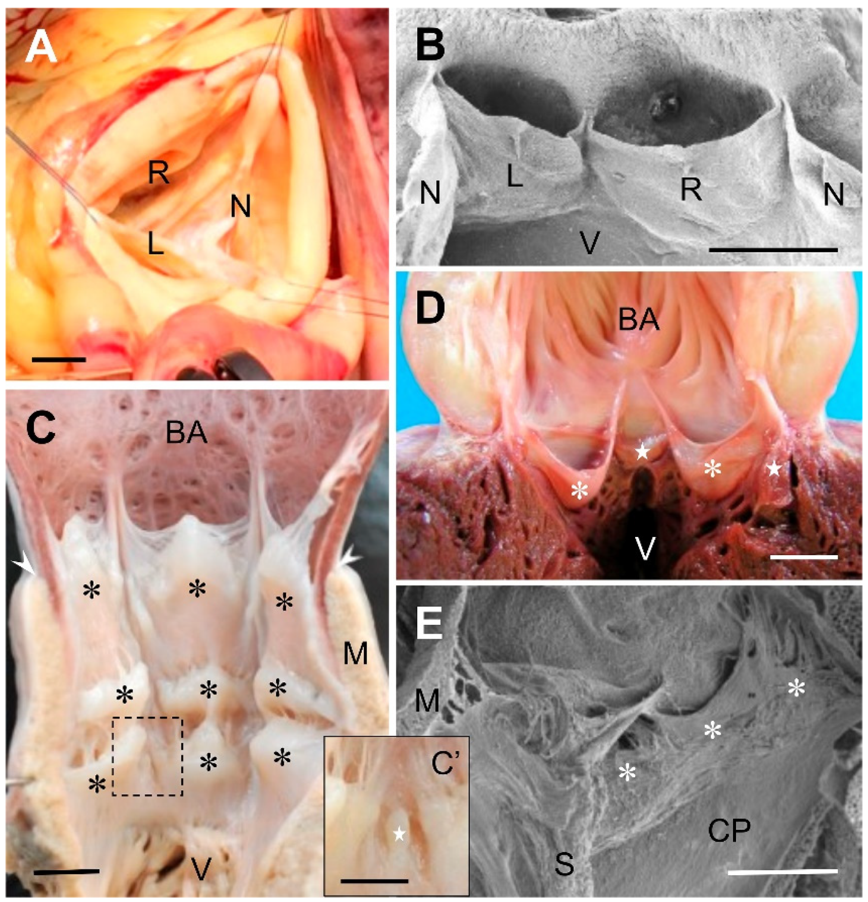 Jcdd 09 00318 g001 Jcdd 09 00318 g001