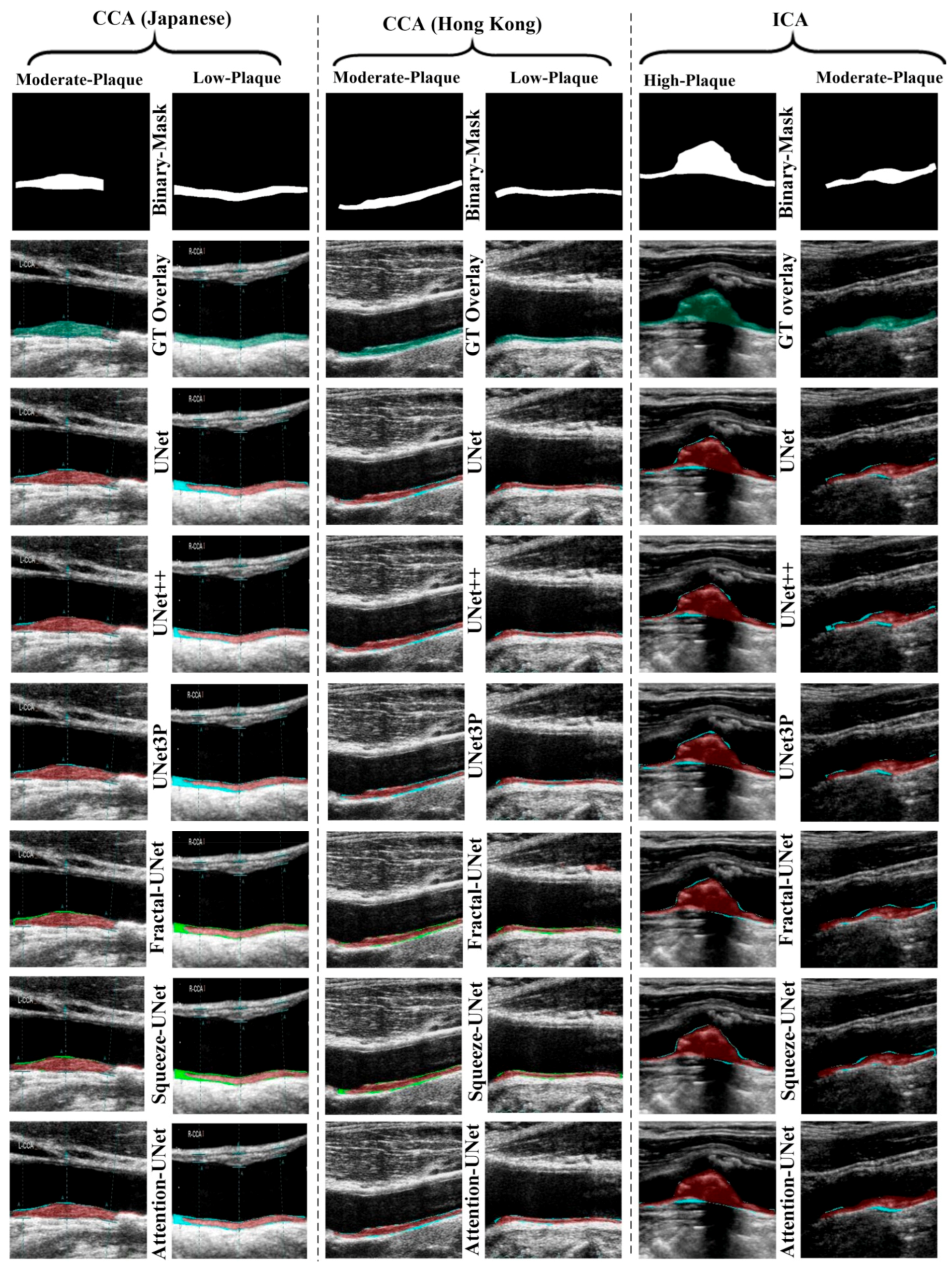 Jcdd 09 00326 g008 Jcdd 09 00326 g008