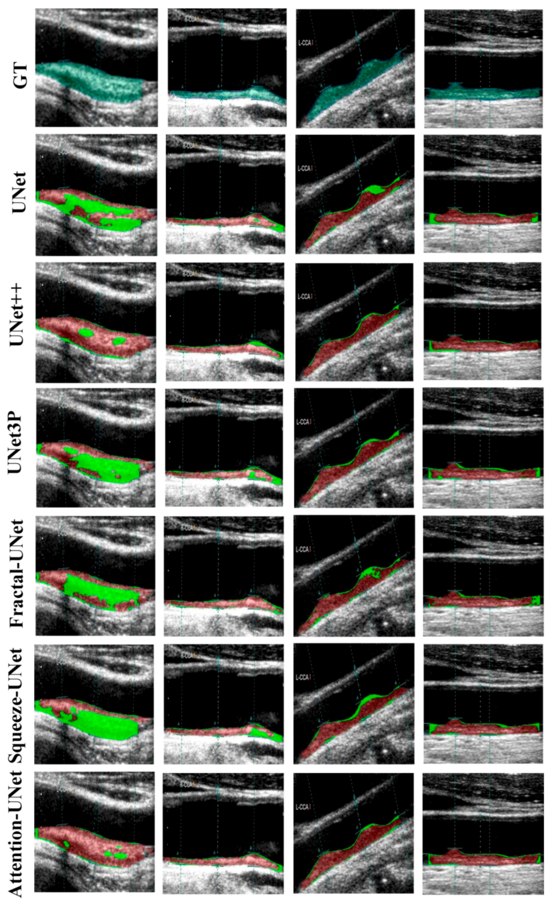 Jcdd 09 00326 g009 Jcdd 09 00326 g009