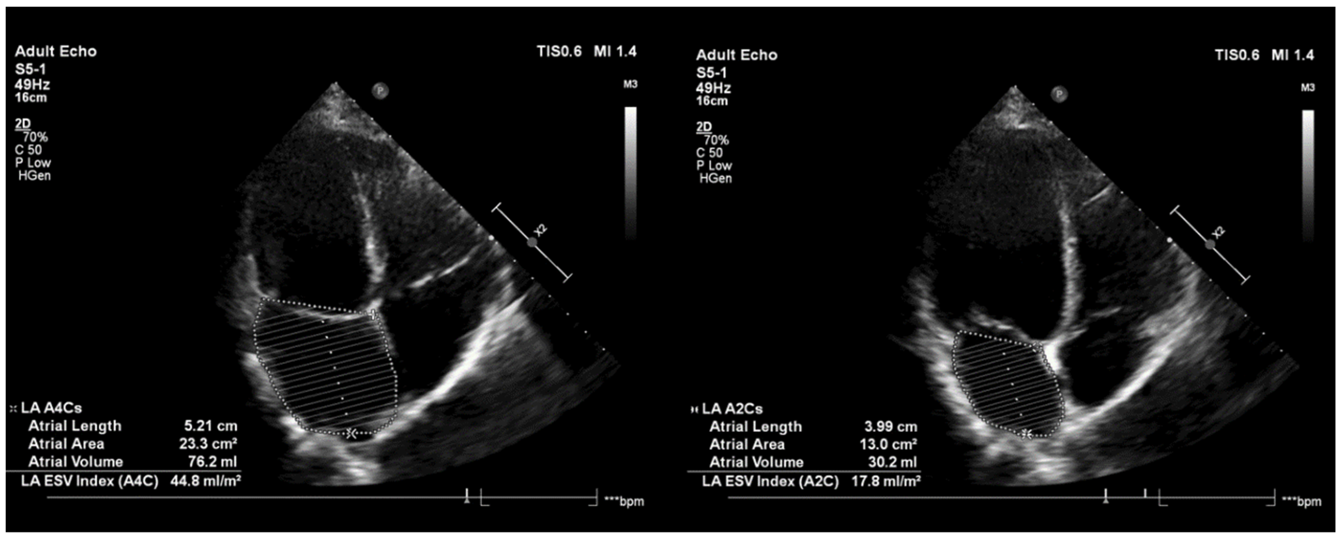 Jcdd 09 00327 g002 Jcdd 09 00327 g002