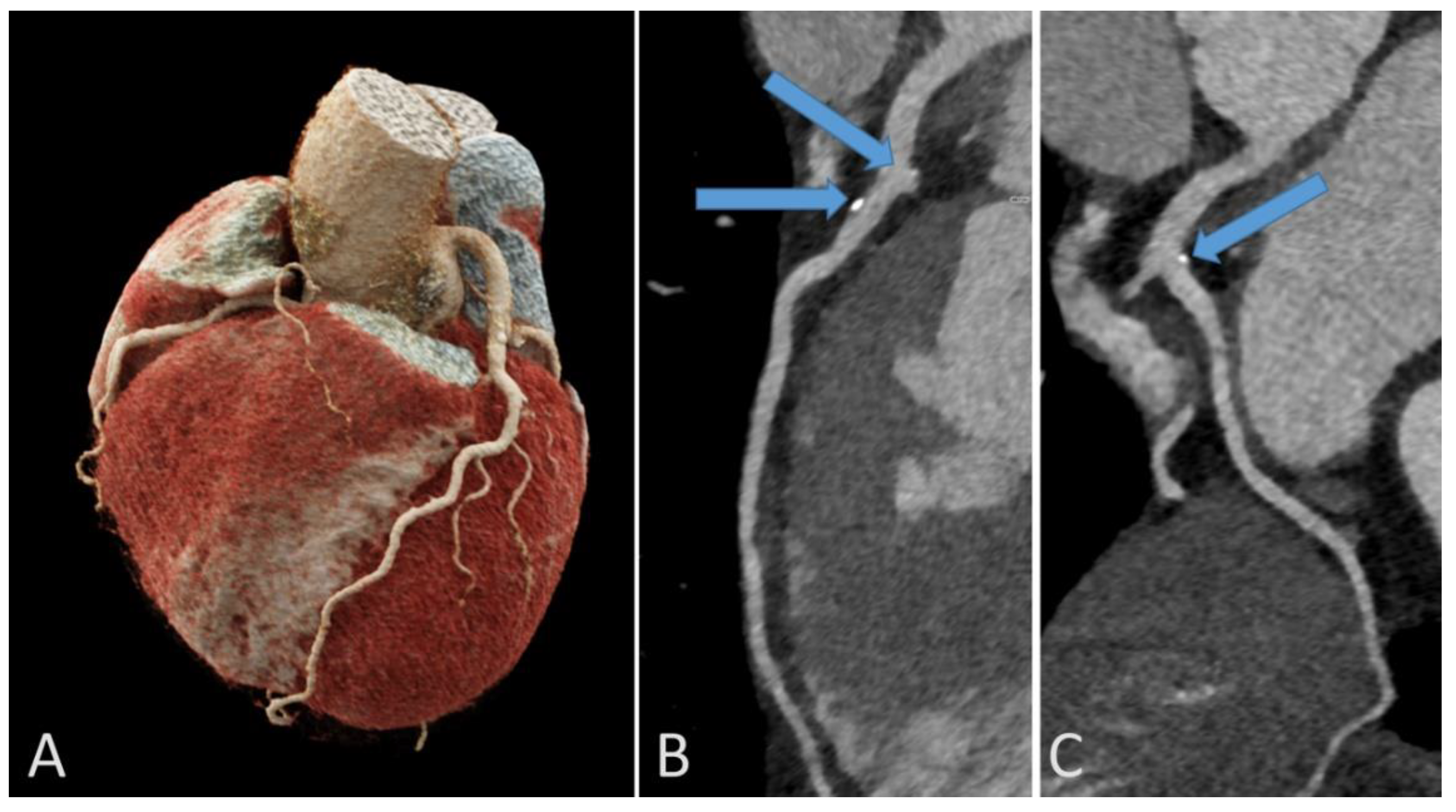 Jcdd 09 00347 g006 Jcdd 09 00347 g006