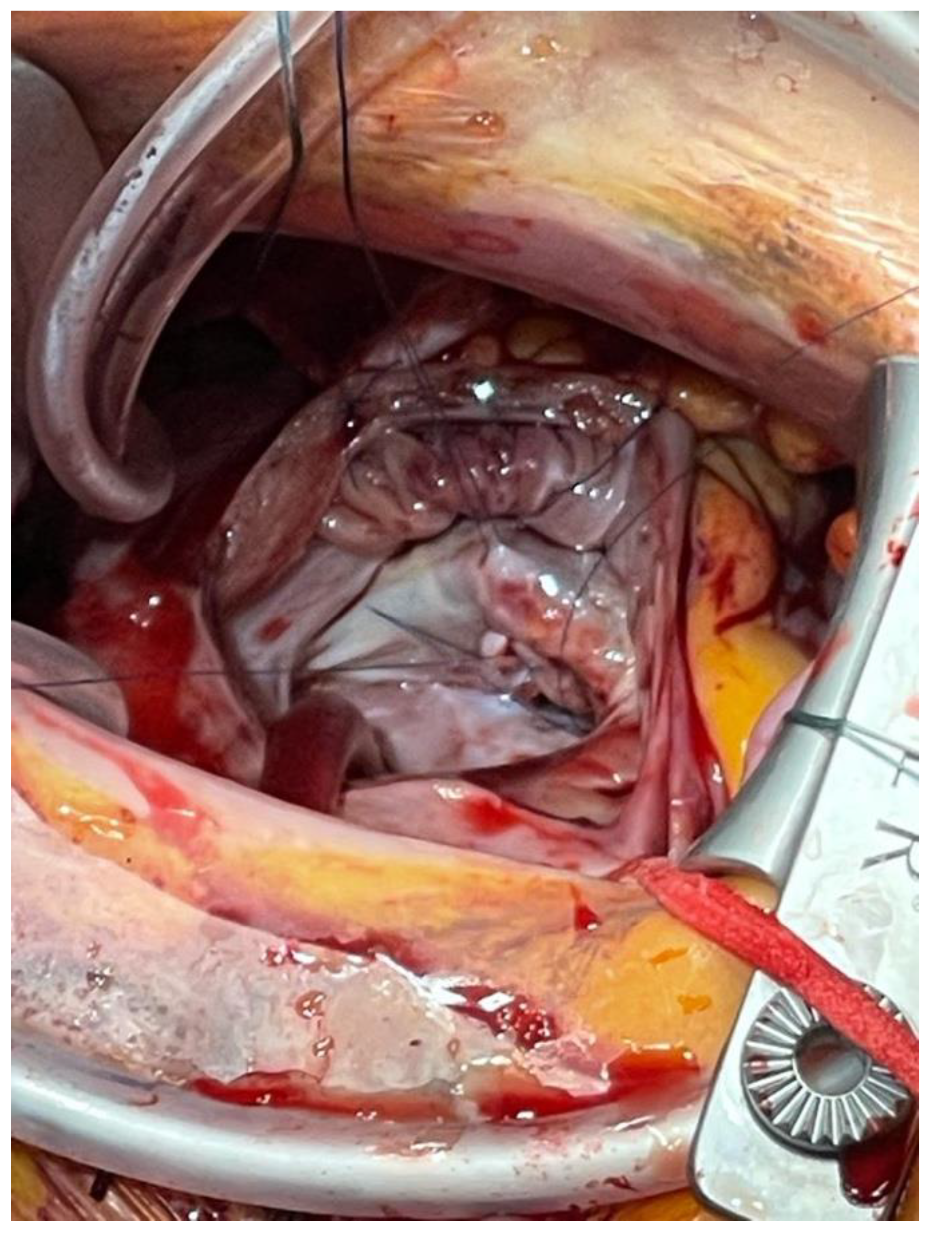 Jcdd 09 00352 g003 Jcdd 09 00352 g003