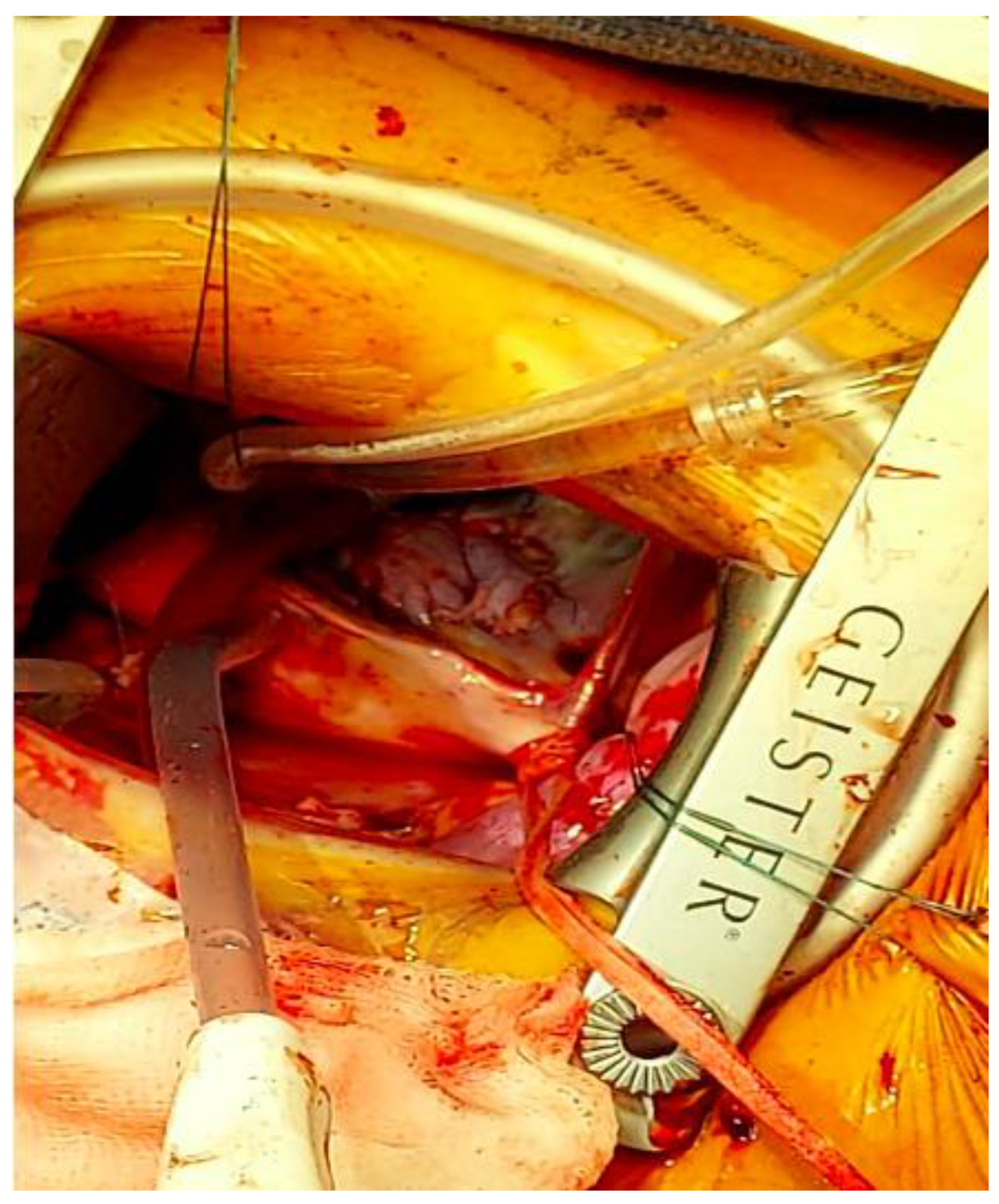 Jcdd 09 00352 g004 Jcdd 09 00352 g004