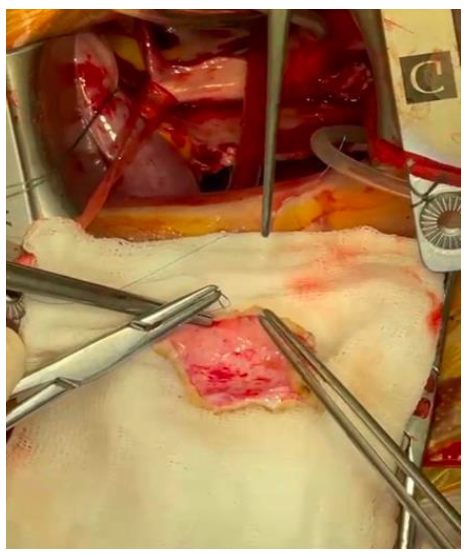 Jcdd 09 00352 g005 Jcdd 09 00352 g005