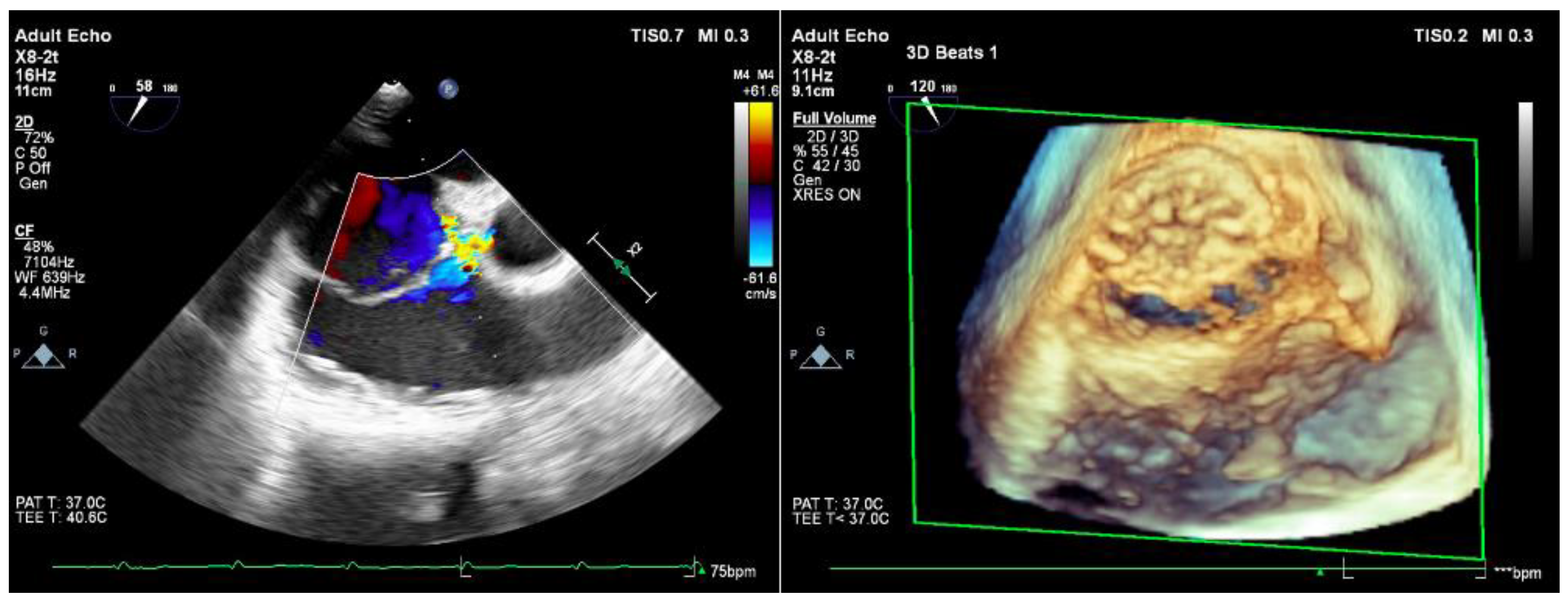Jcdd 09 00352 g006 Jcdd 09 00352 g006