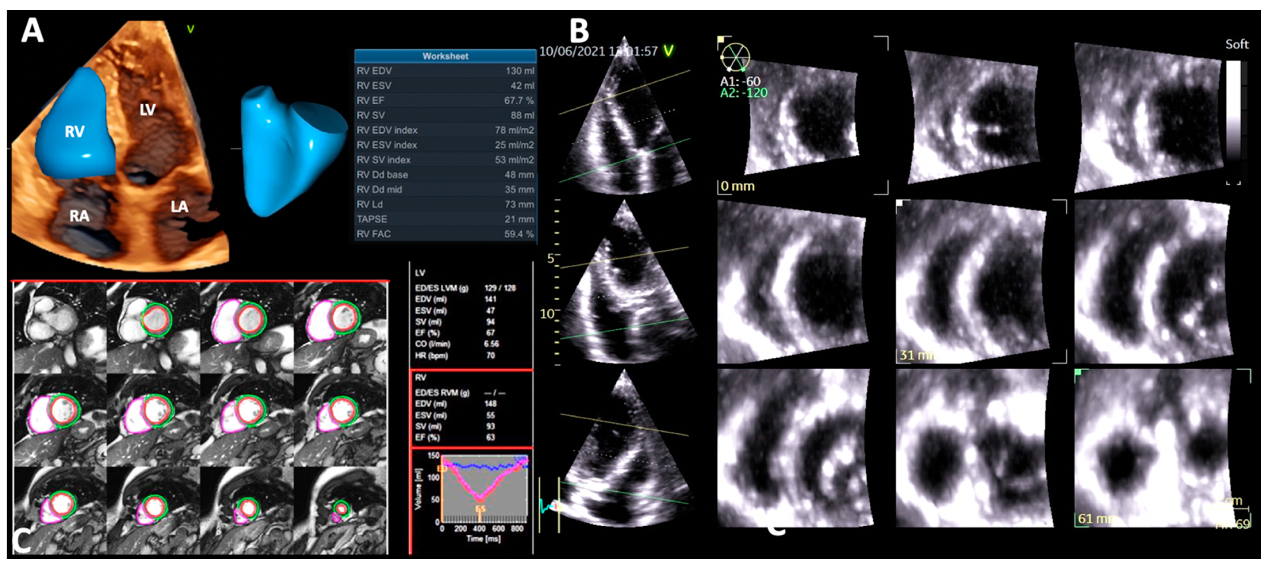 Jcdd 09 00359 g001 Jcdd 09 00359 g001