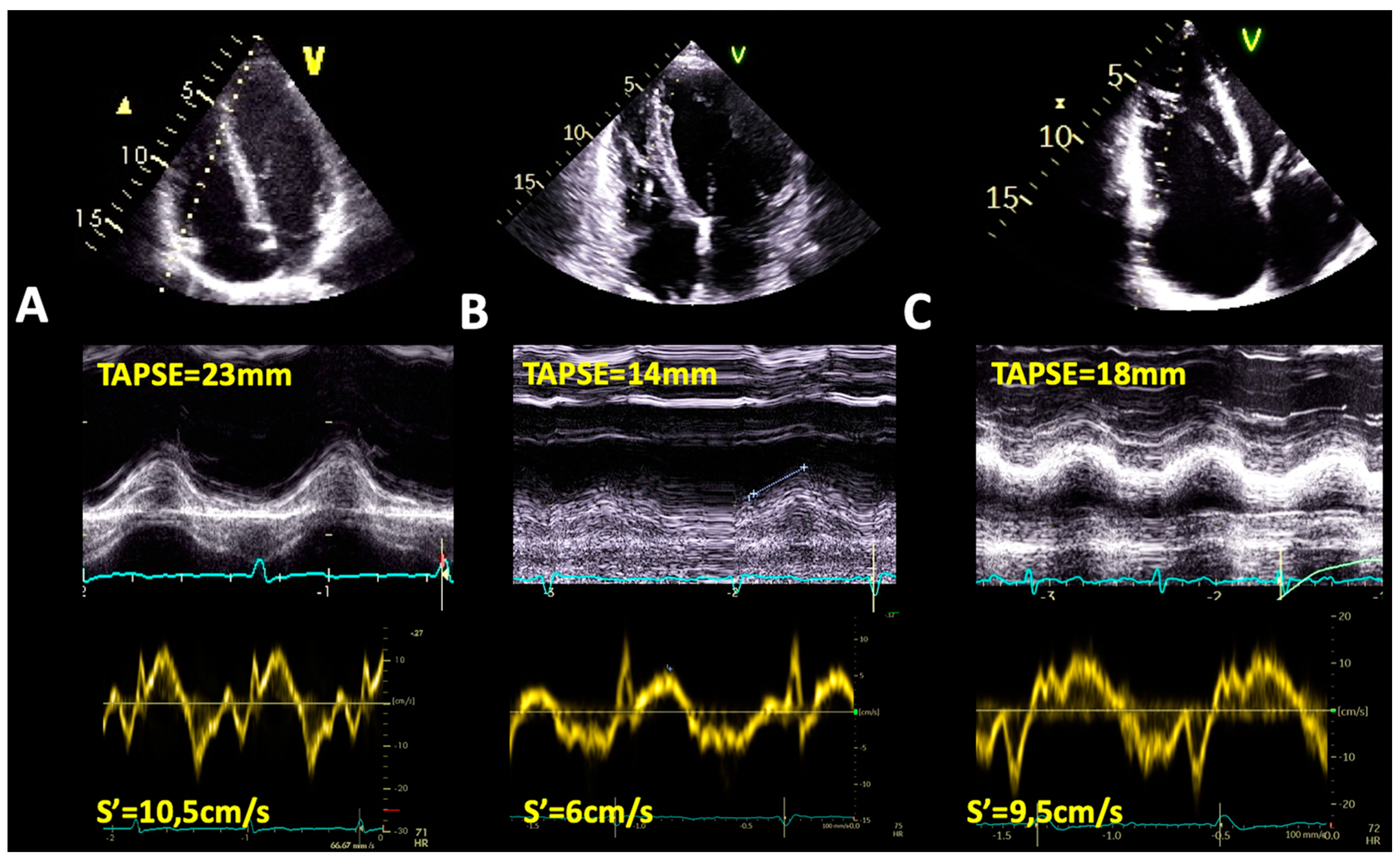 Jcdd 09 00359 g002 Jcdd 09 00359 g002