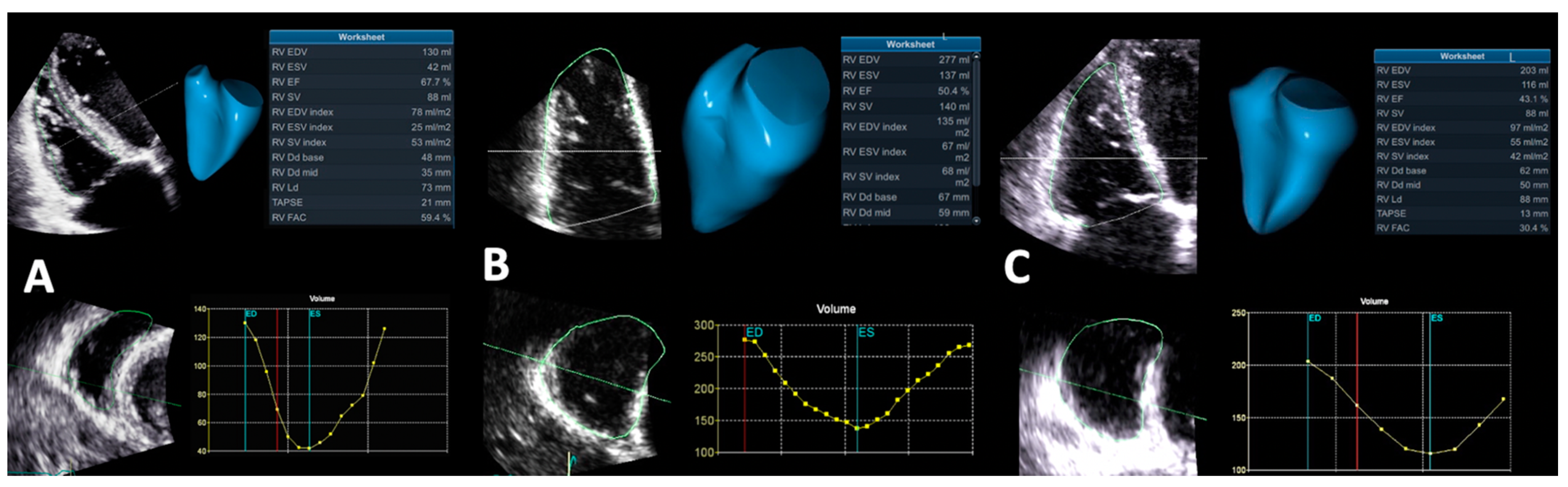 Jcdd 09 00359 g005 Jcdd 09 00359 g005