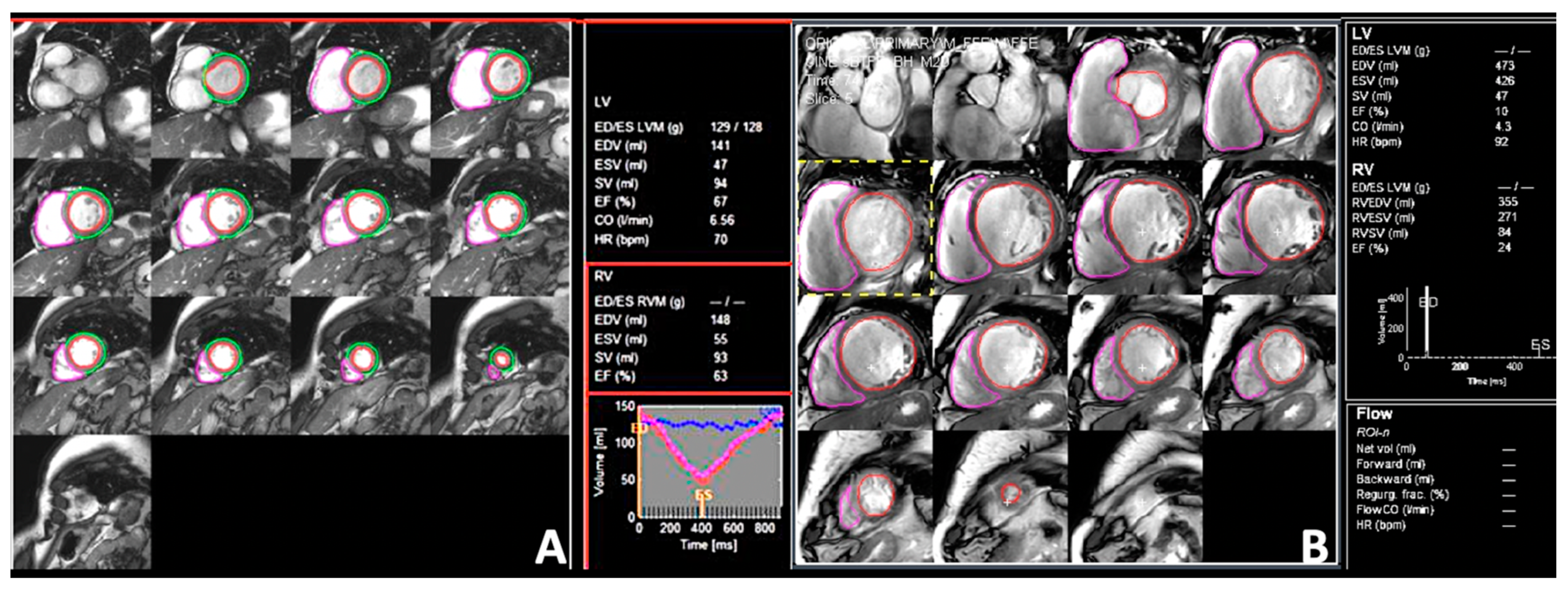 Jcdd 09 00359 g006 Jcdd 09 00359 g006