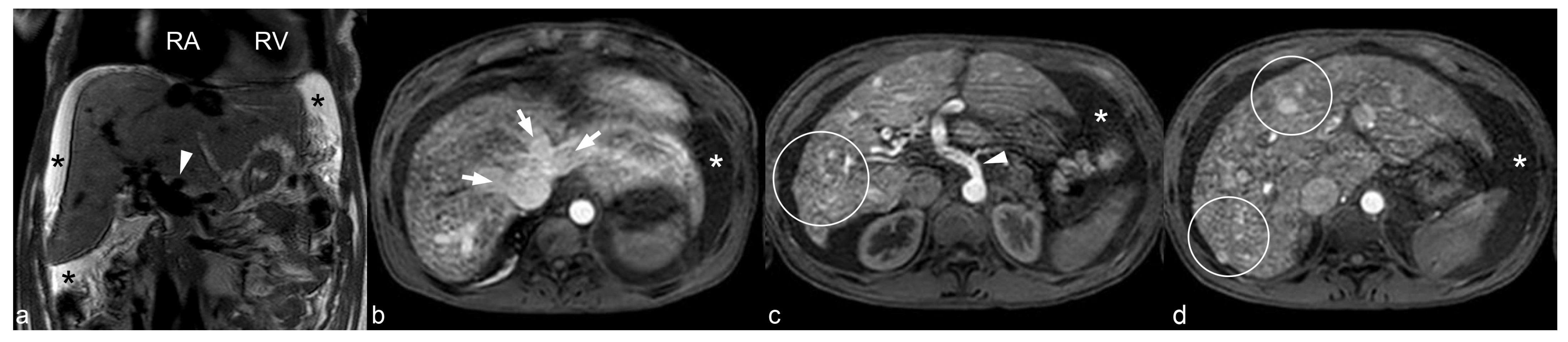 Jcdd 09 00418 g004 Jcdd 09 00418 g004