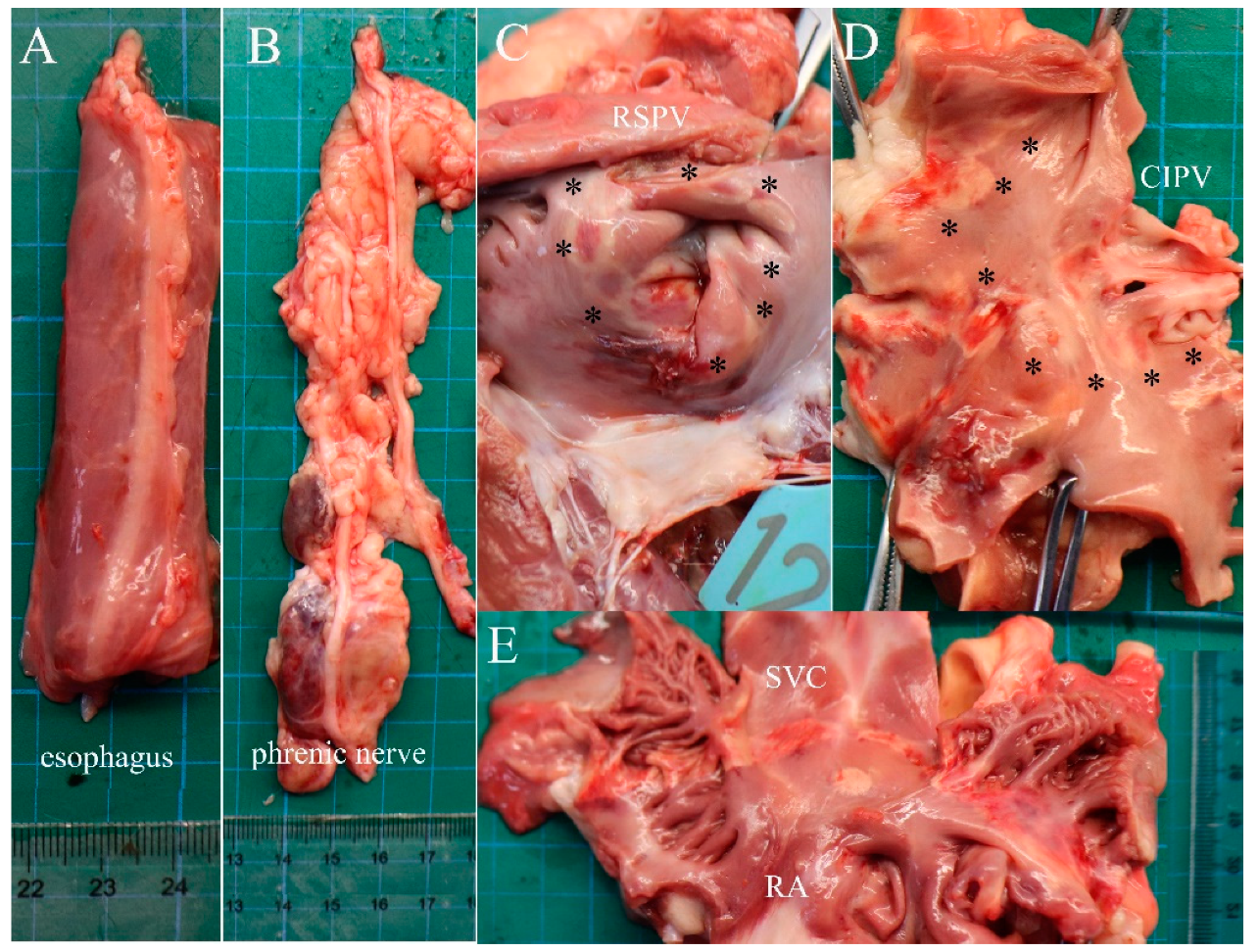 Jcdd 09 00425 g006 Jcdd 09 00425 g006