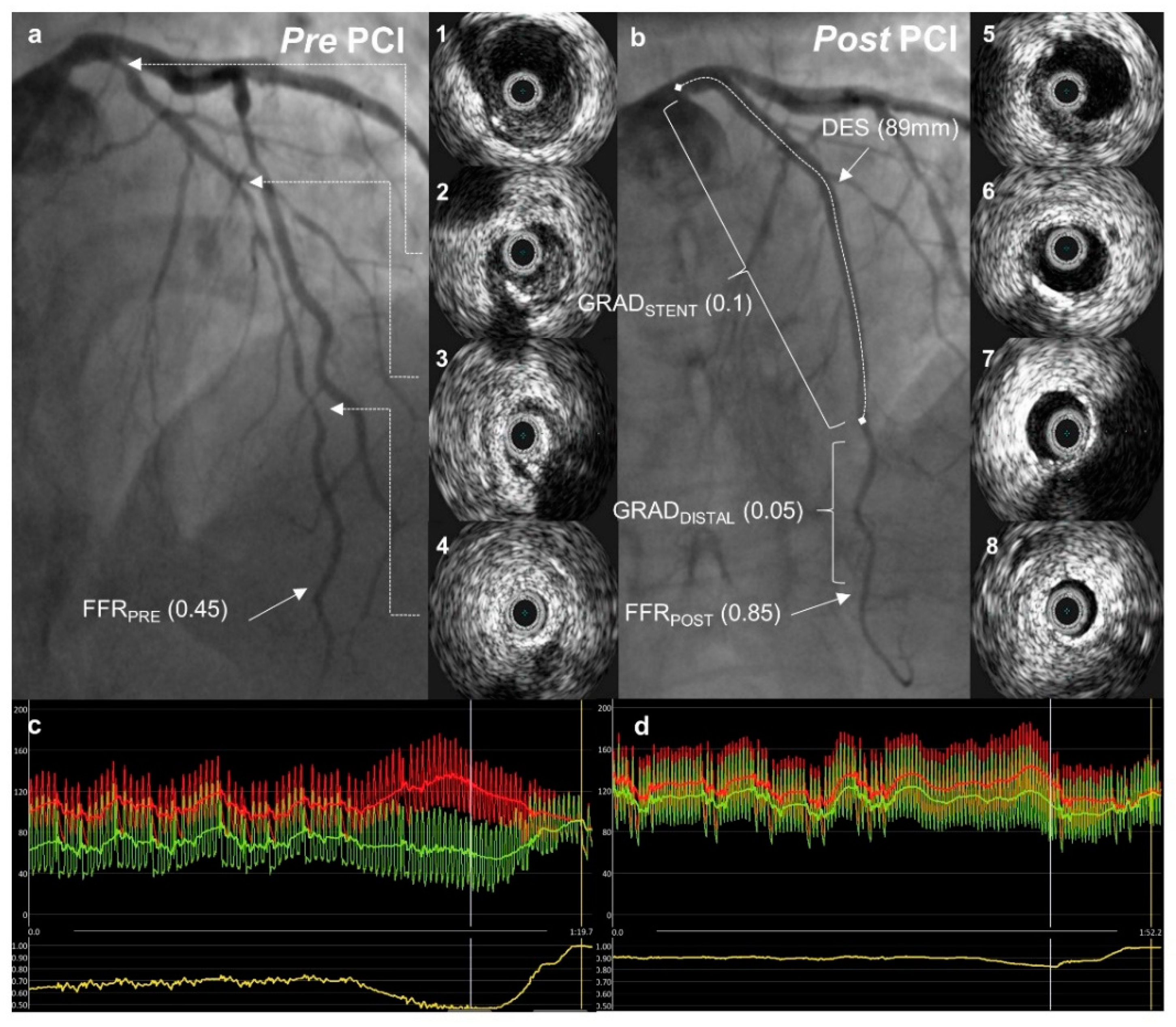 Jcdd 09 00445 g002 Jcdd 09 00445 g002