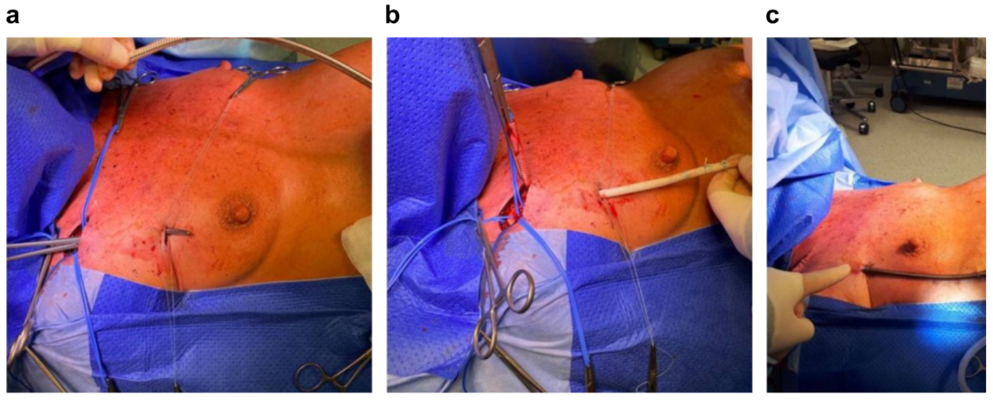 Jcdd 09 00457 g003 Jcdd 09 00457 g003